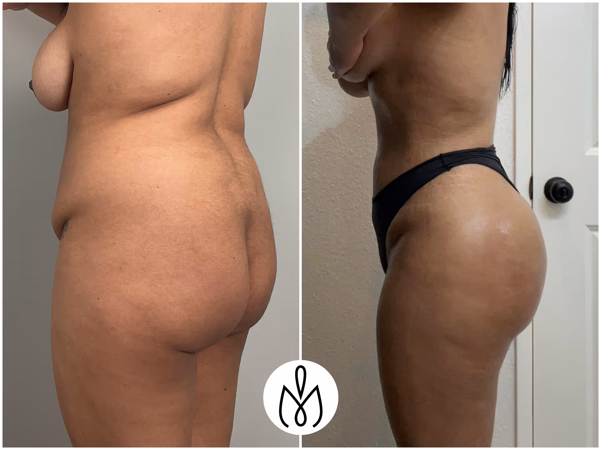 Before,After