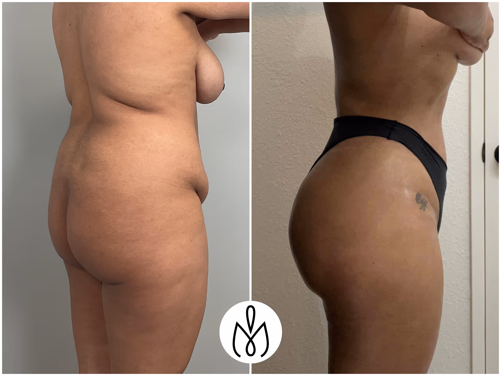 Before,After