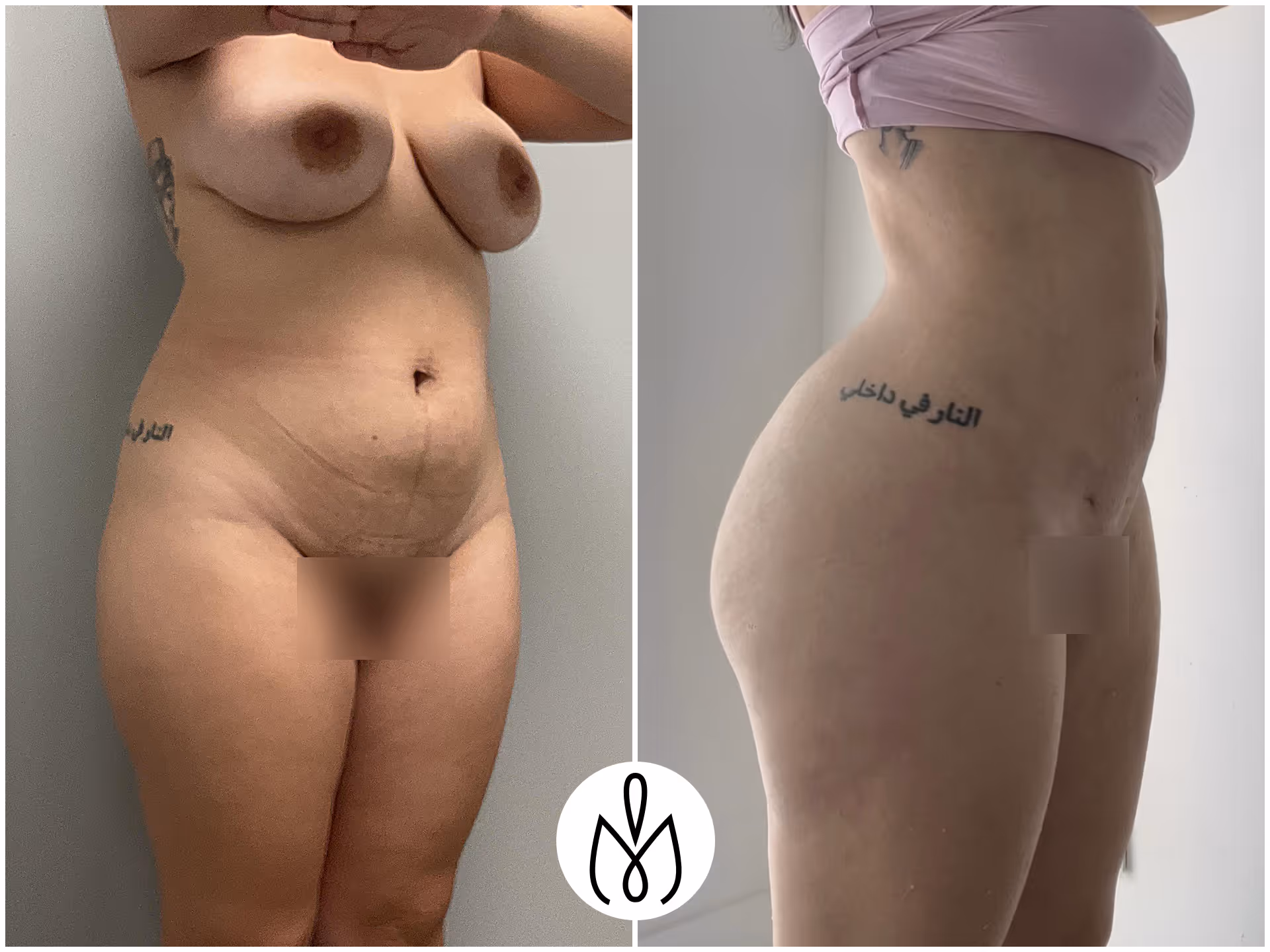 Before,After