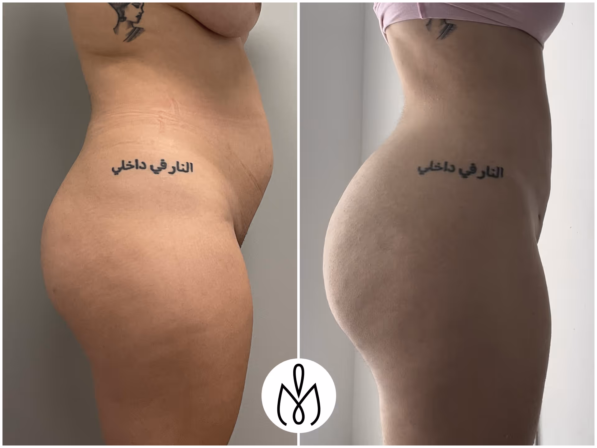 Before,After