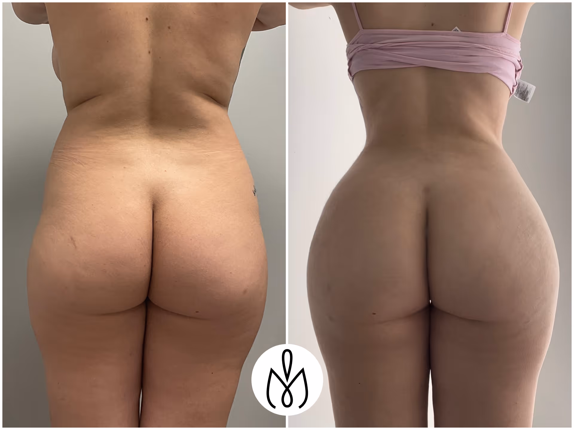 Before,After