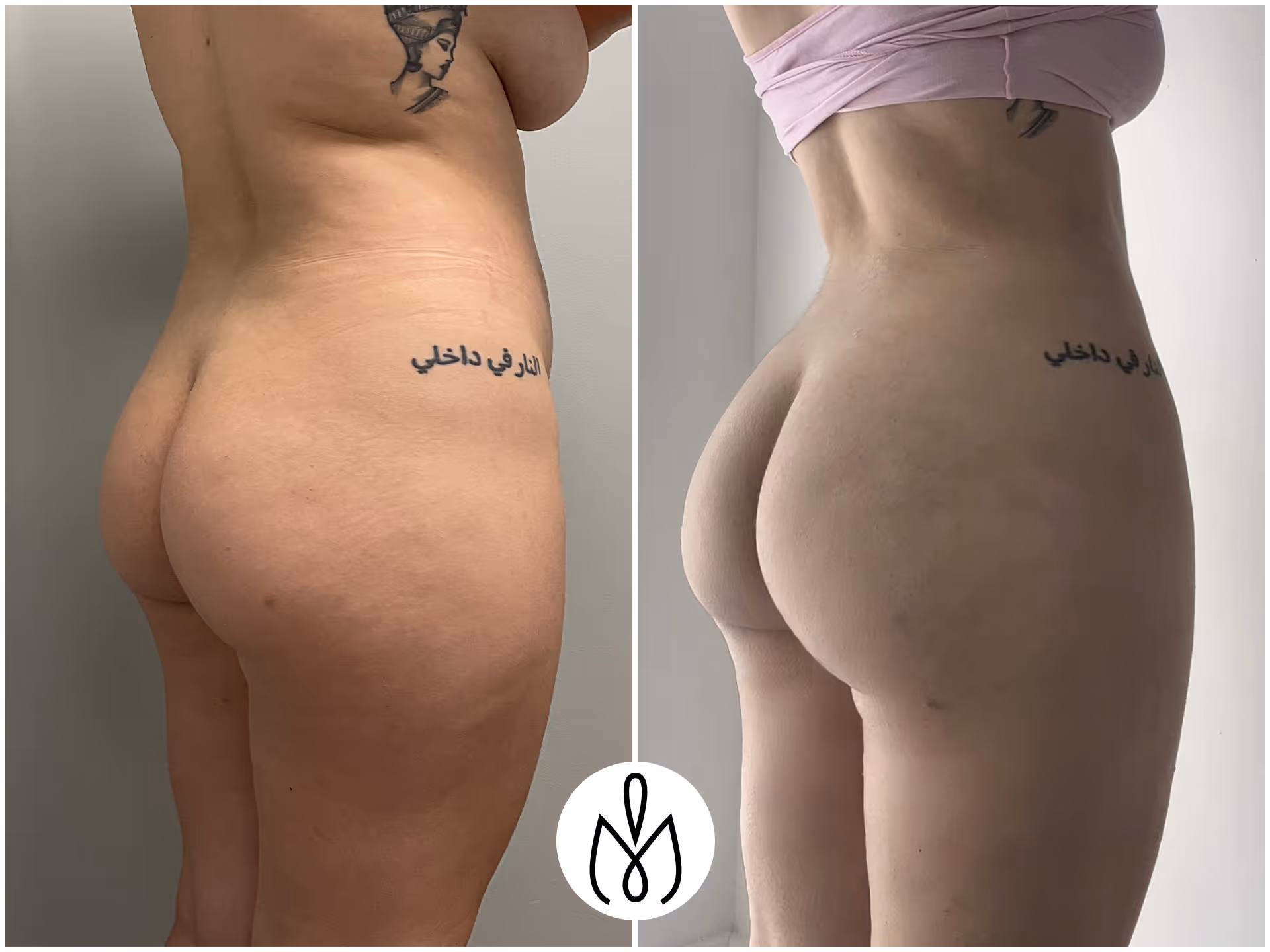 Before,After
