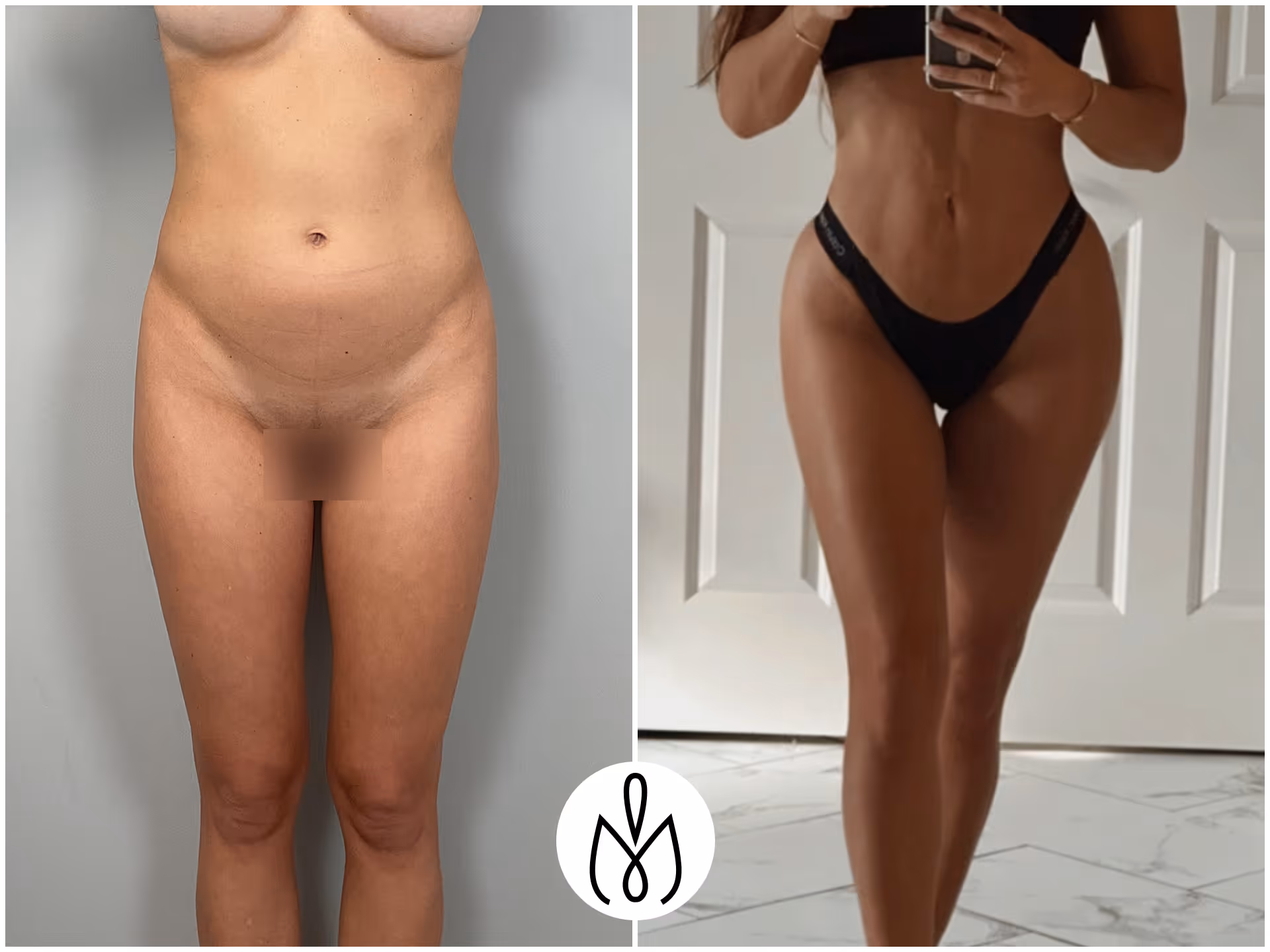 Before,After