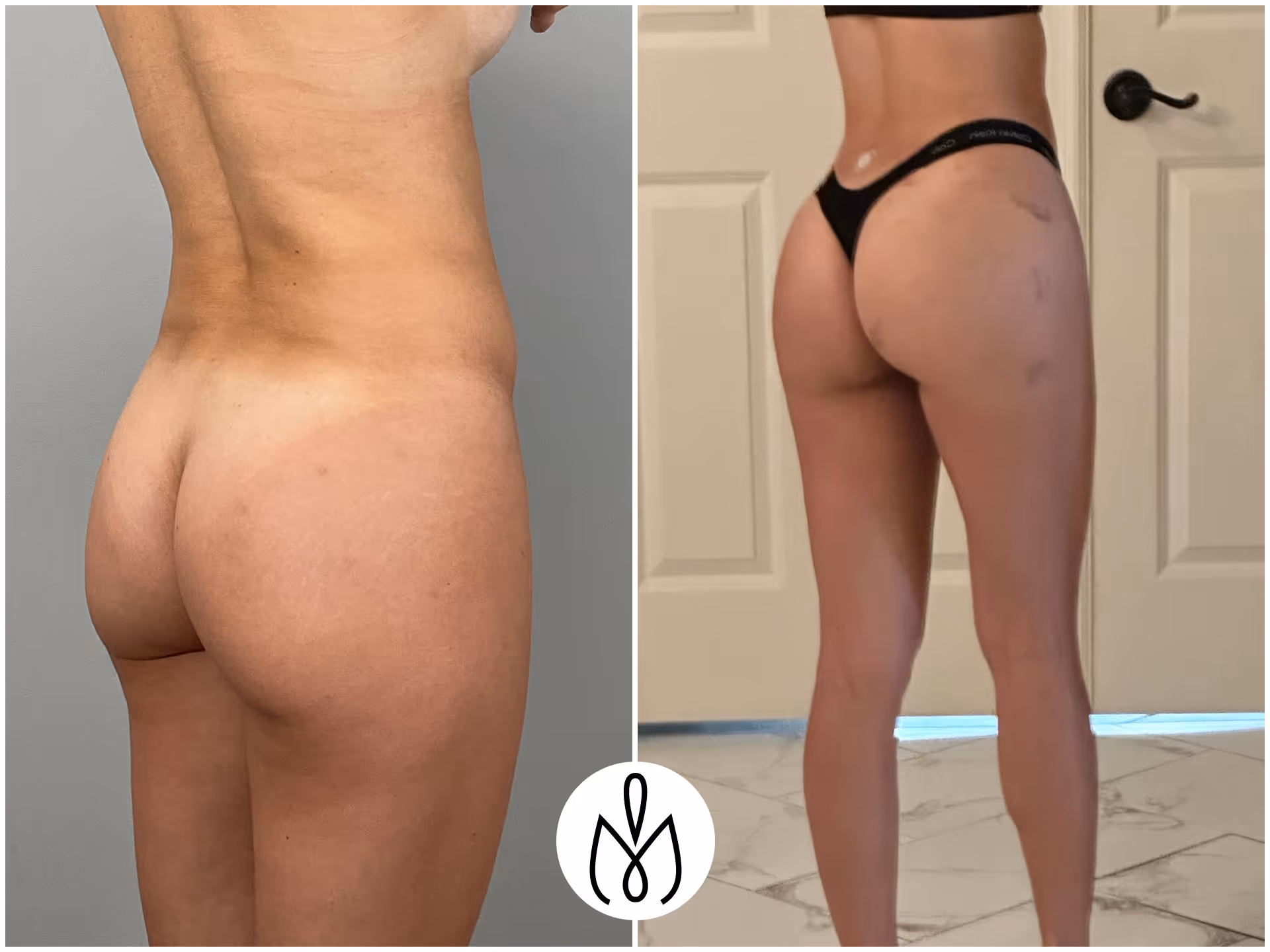 Before,After