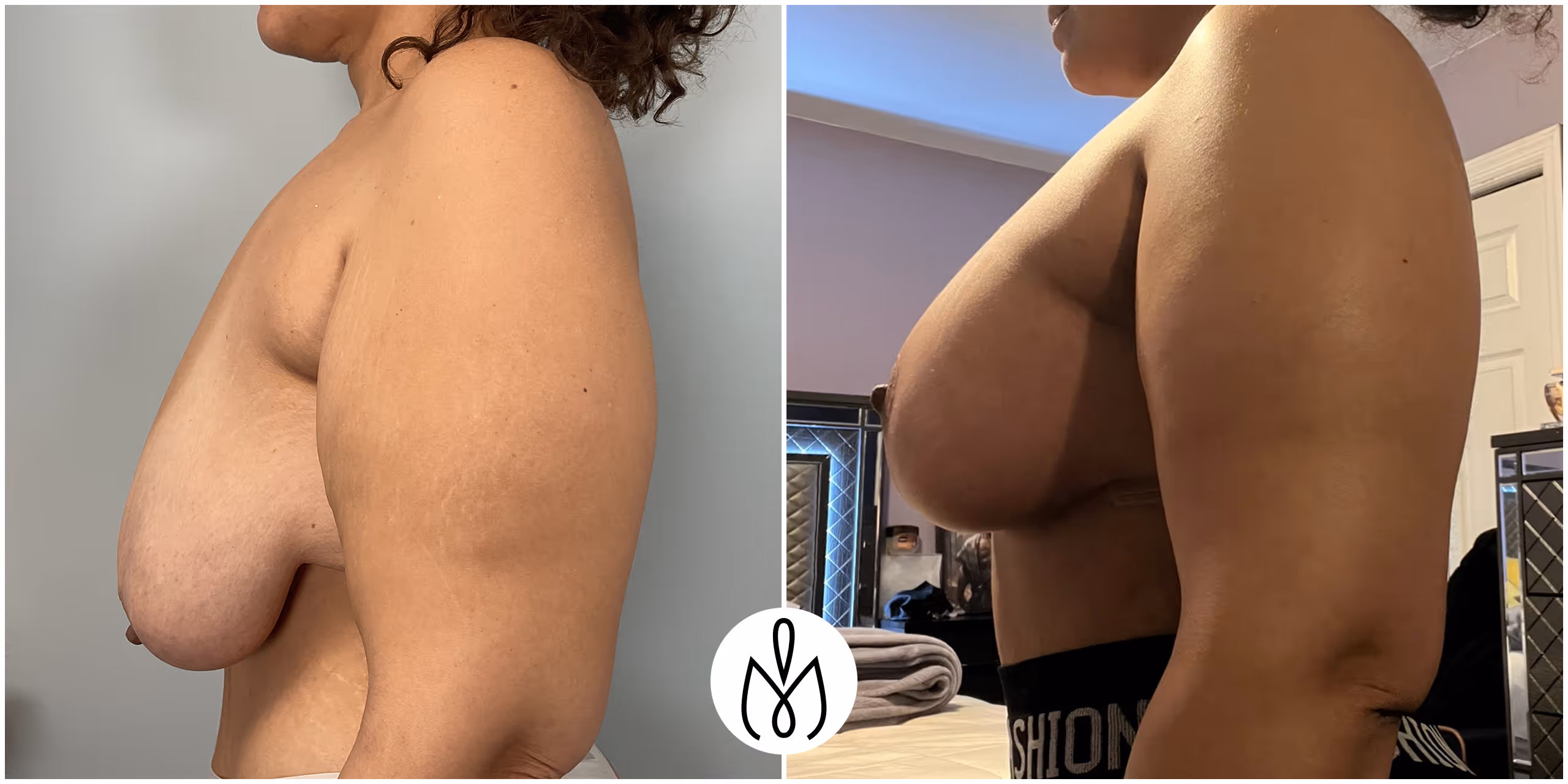 Before,After