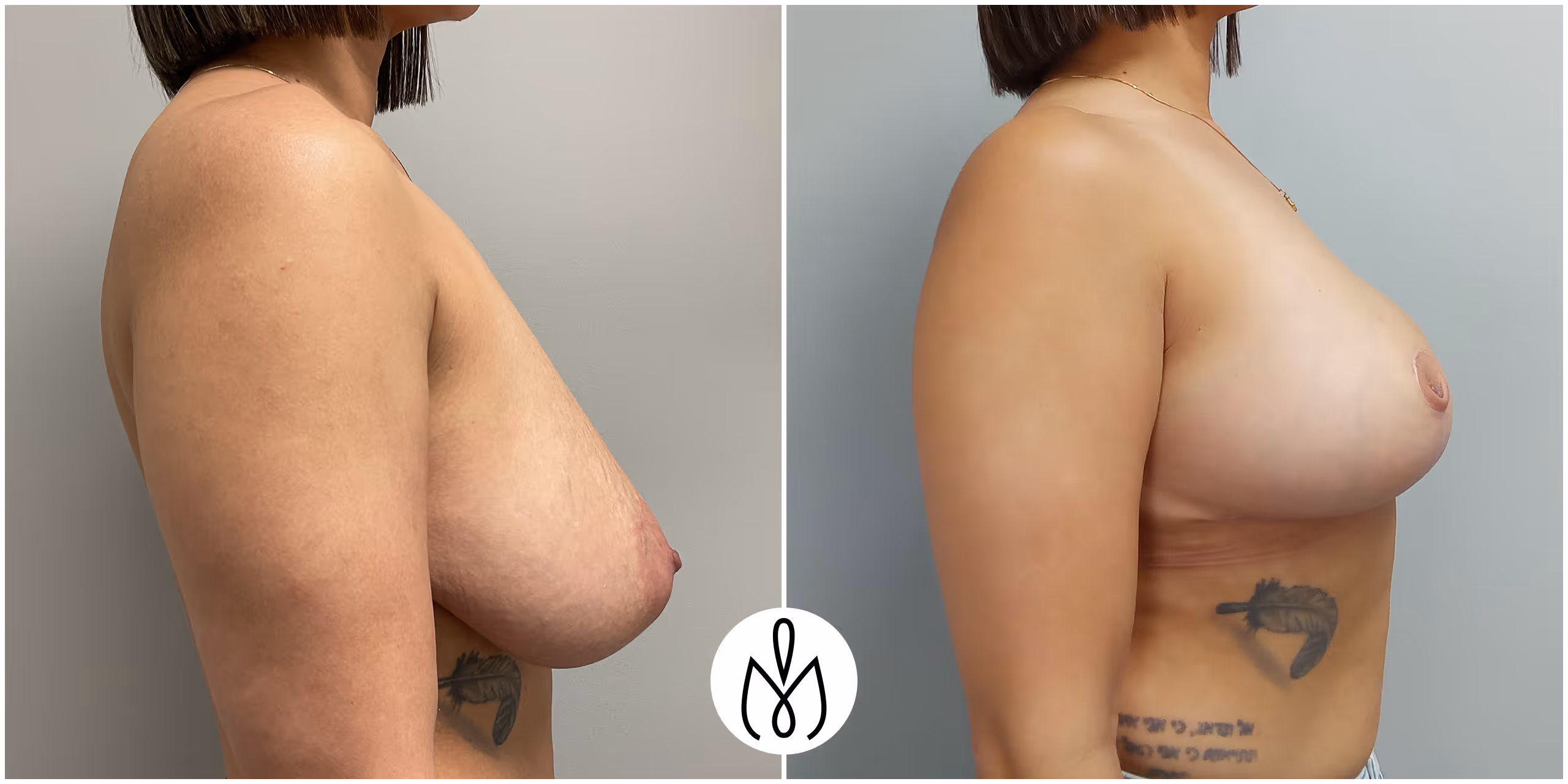 Before,After