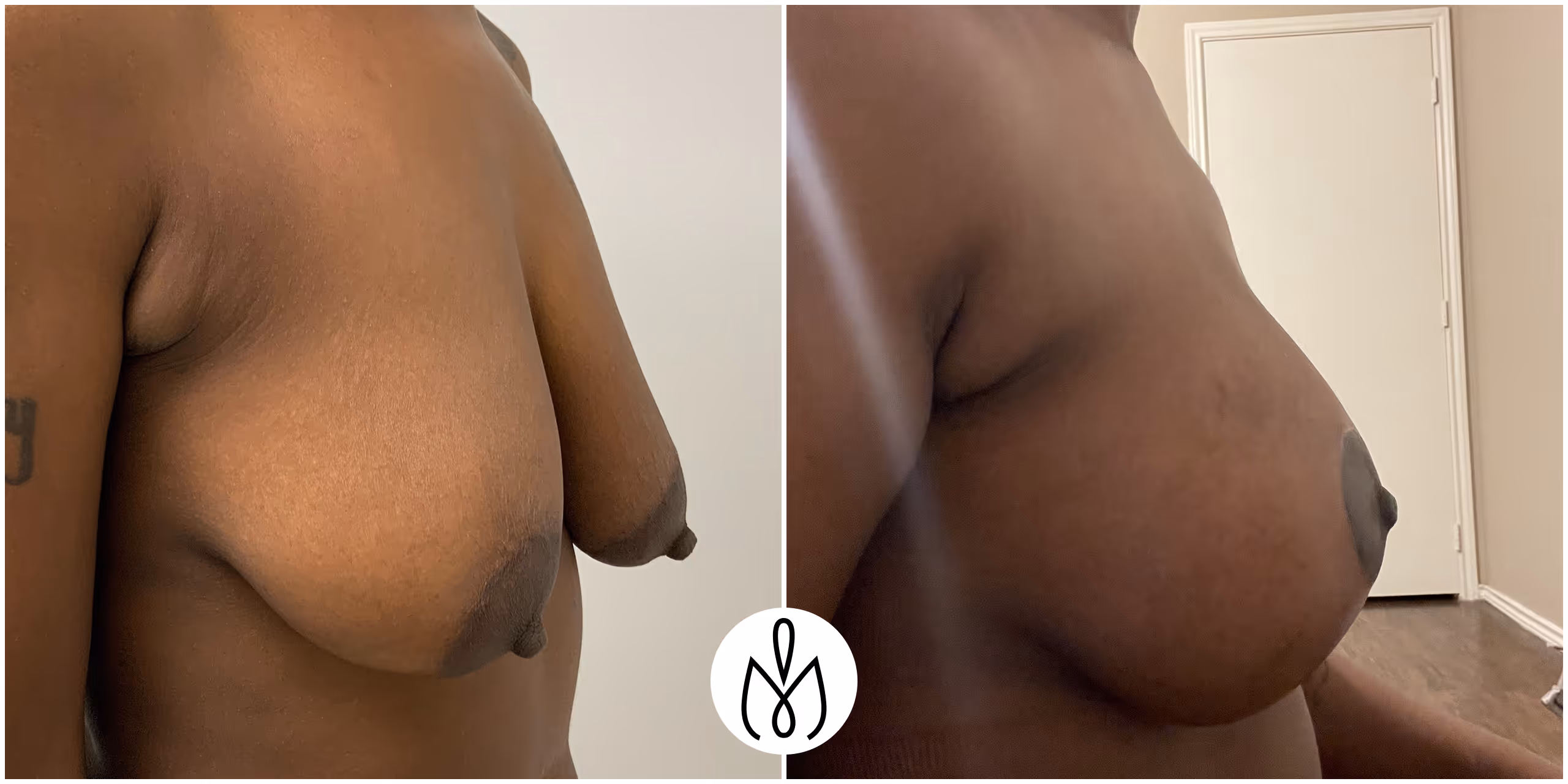 Before,After