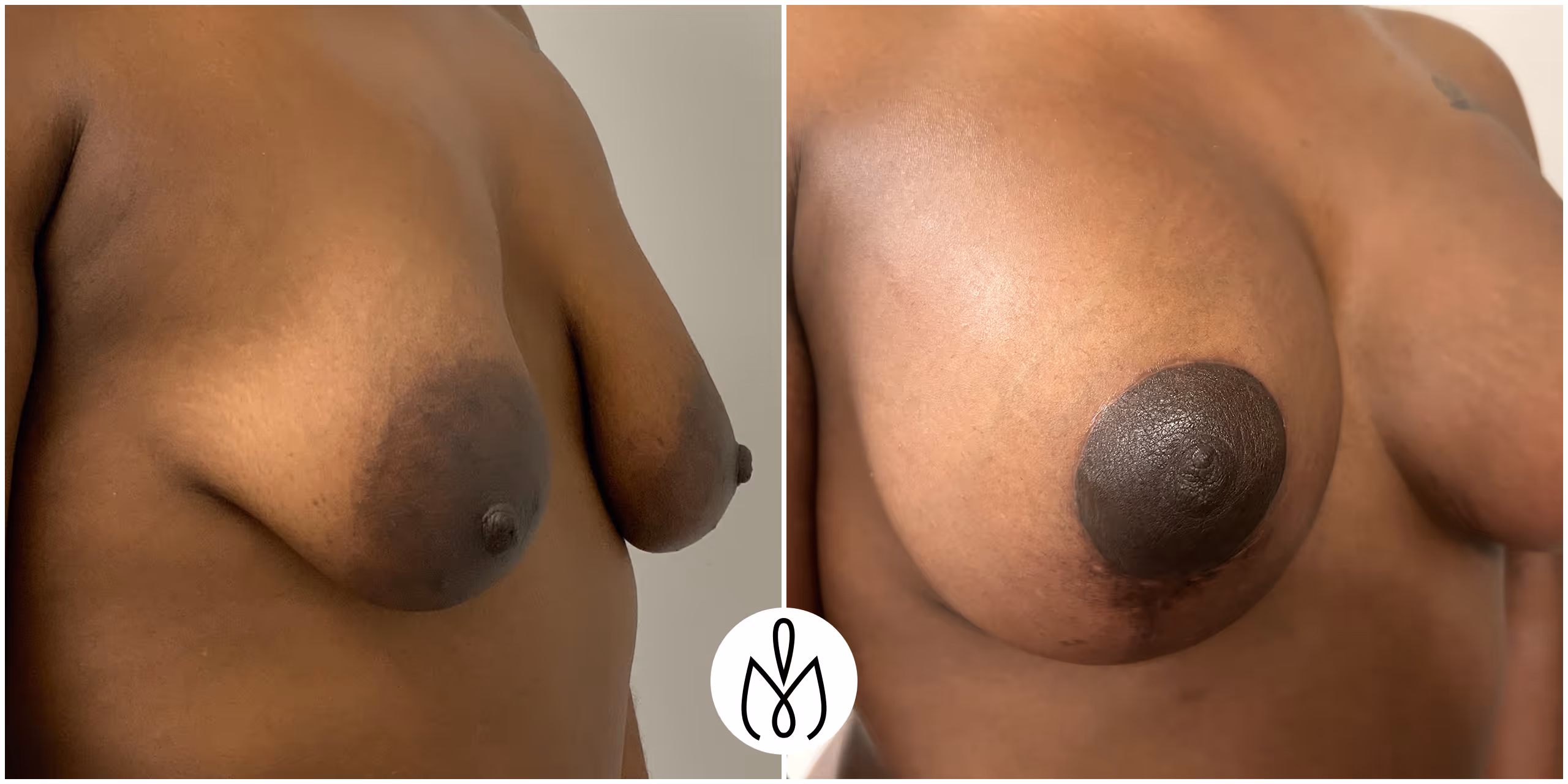 Before,After