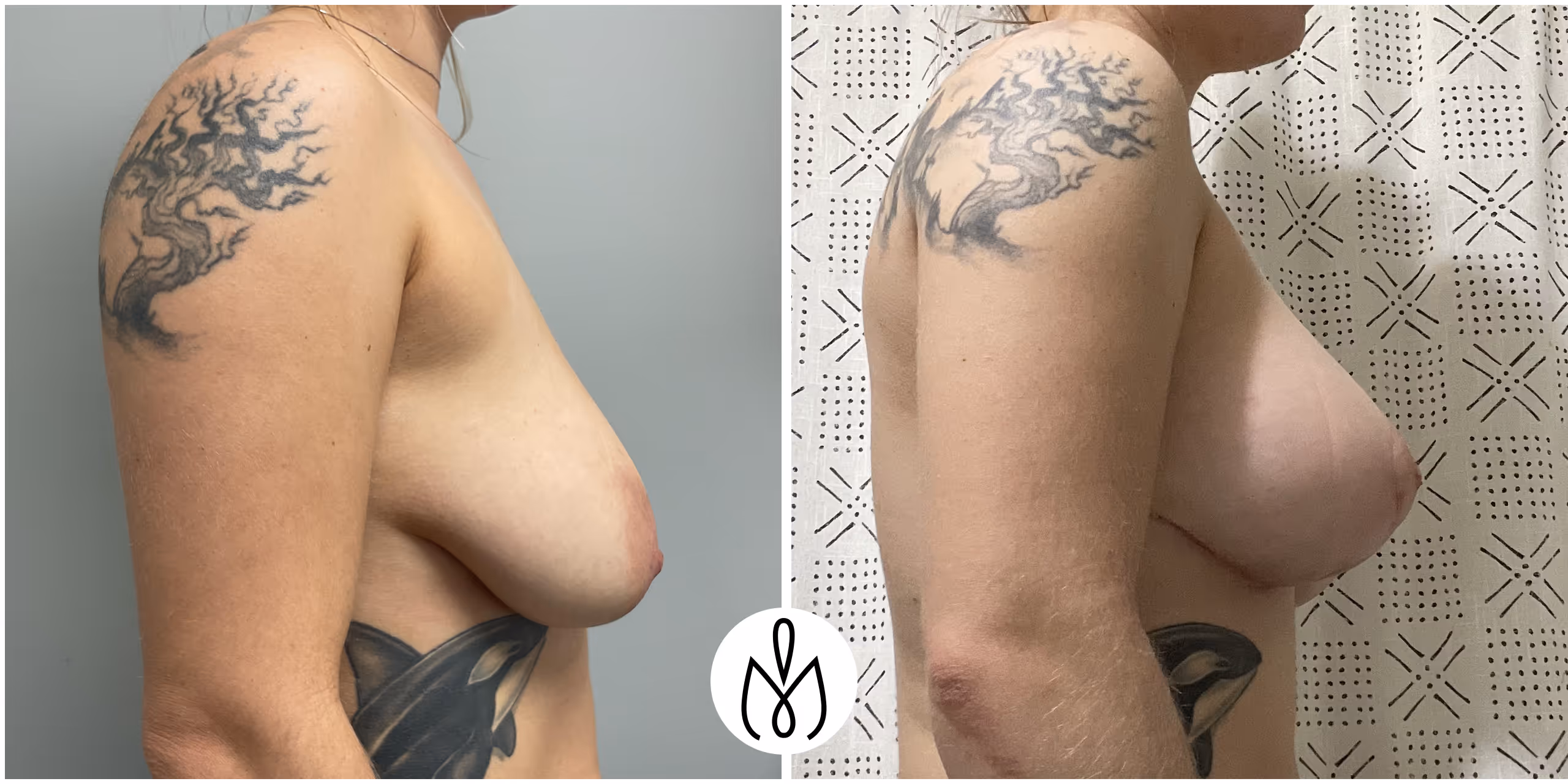 Before,After