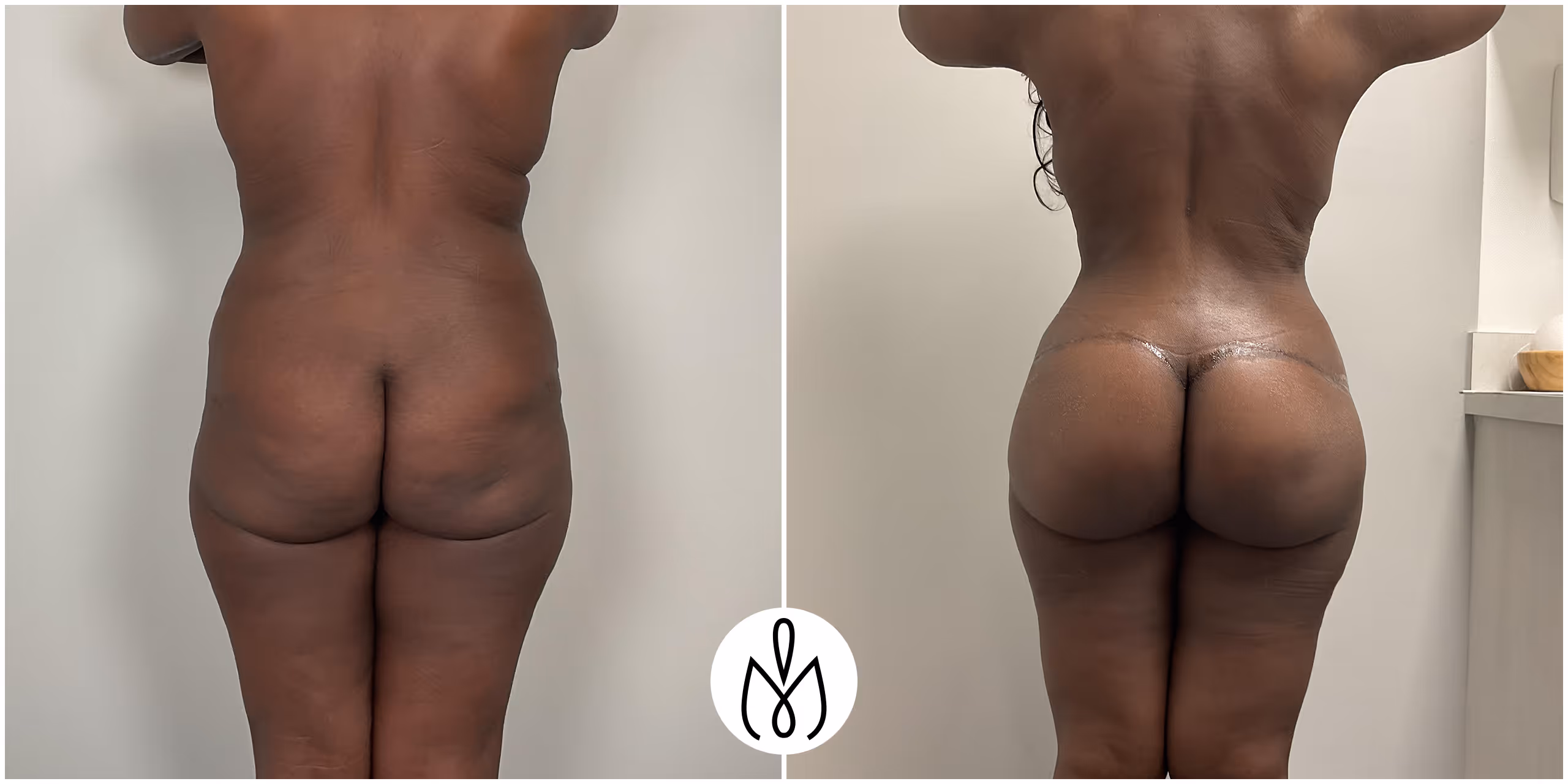 Before,After