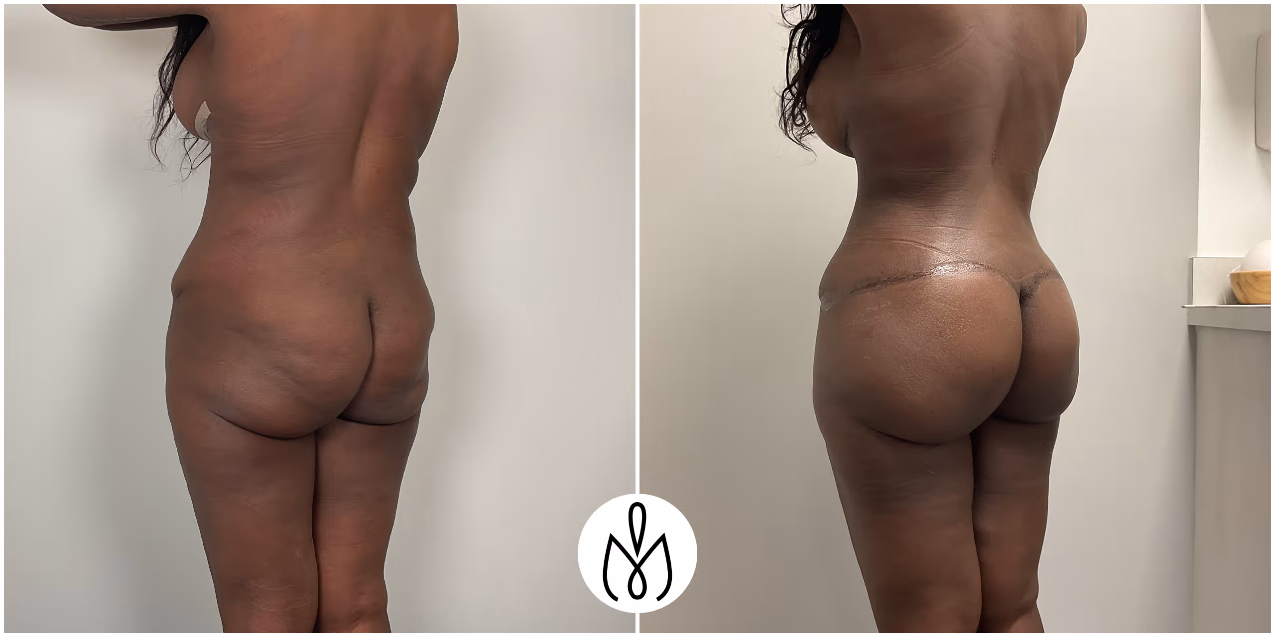 Before,After
