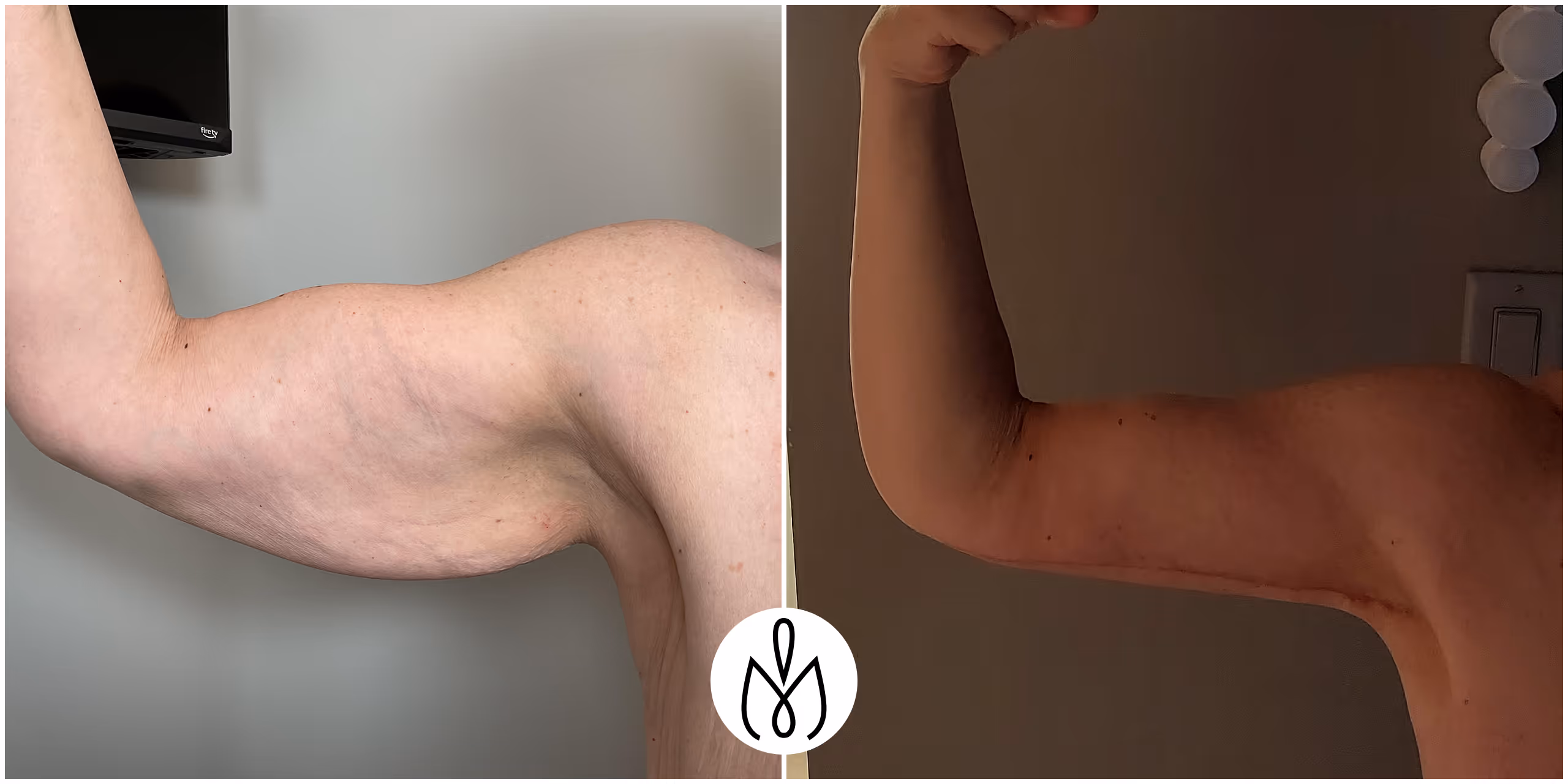 Before,After