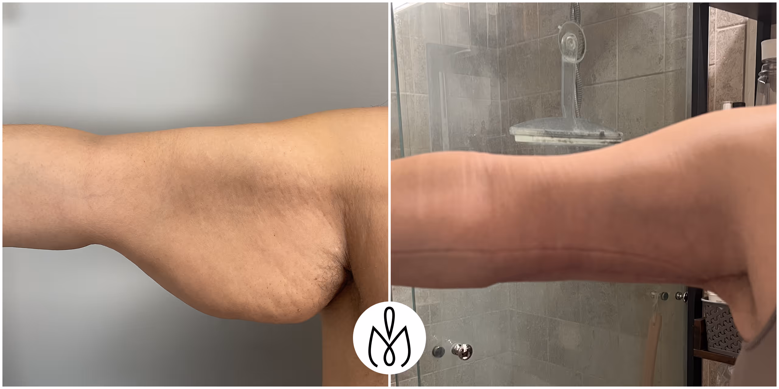 Before,After