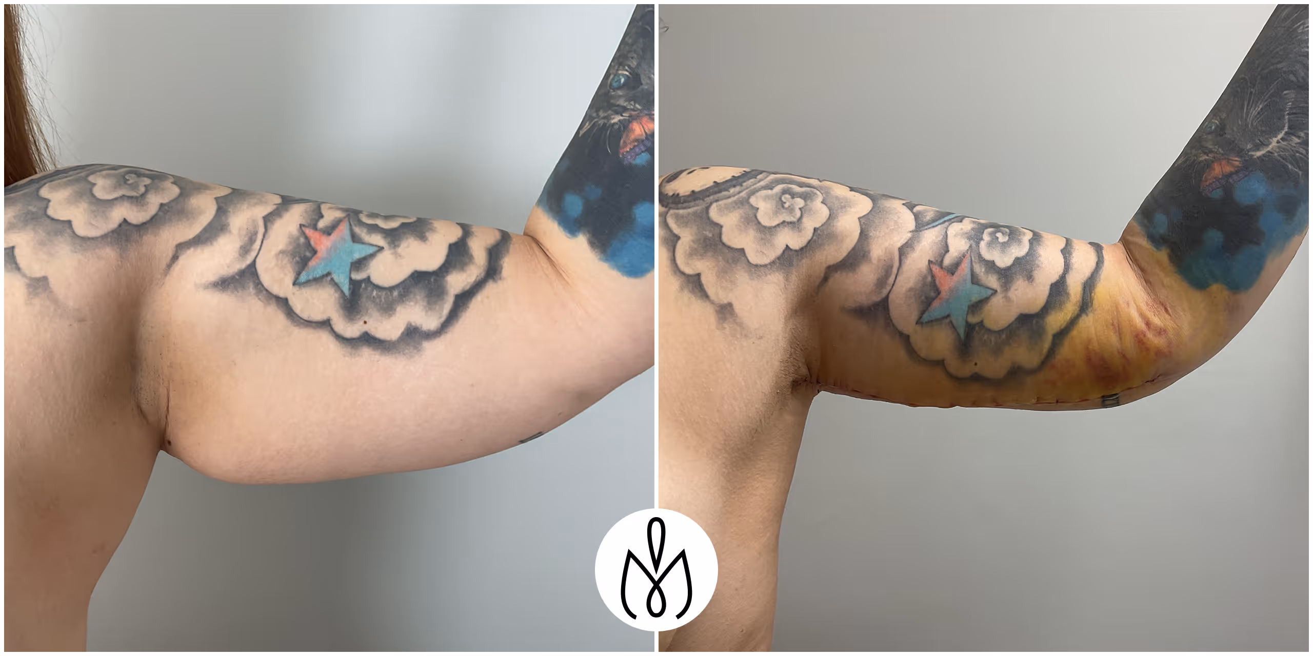 Before,After