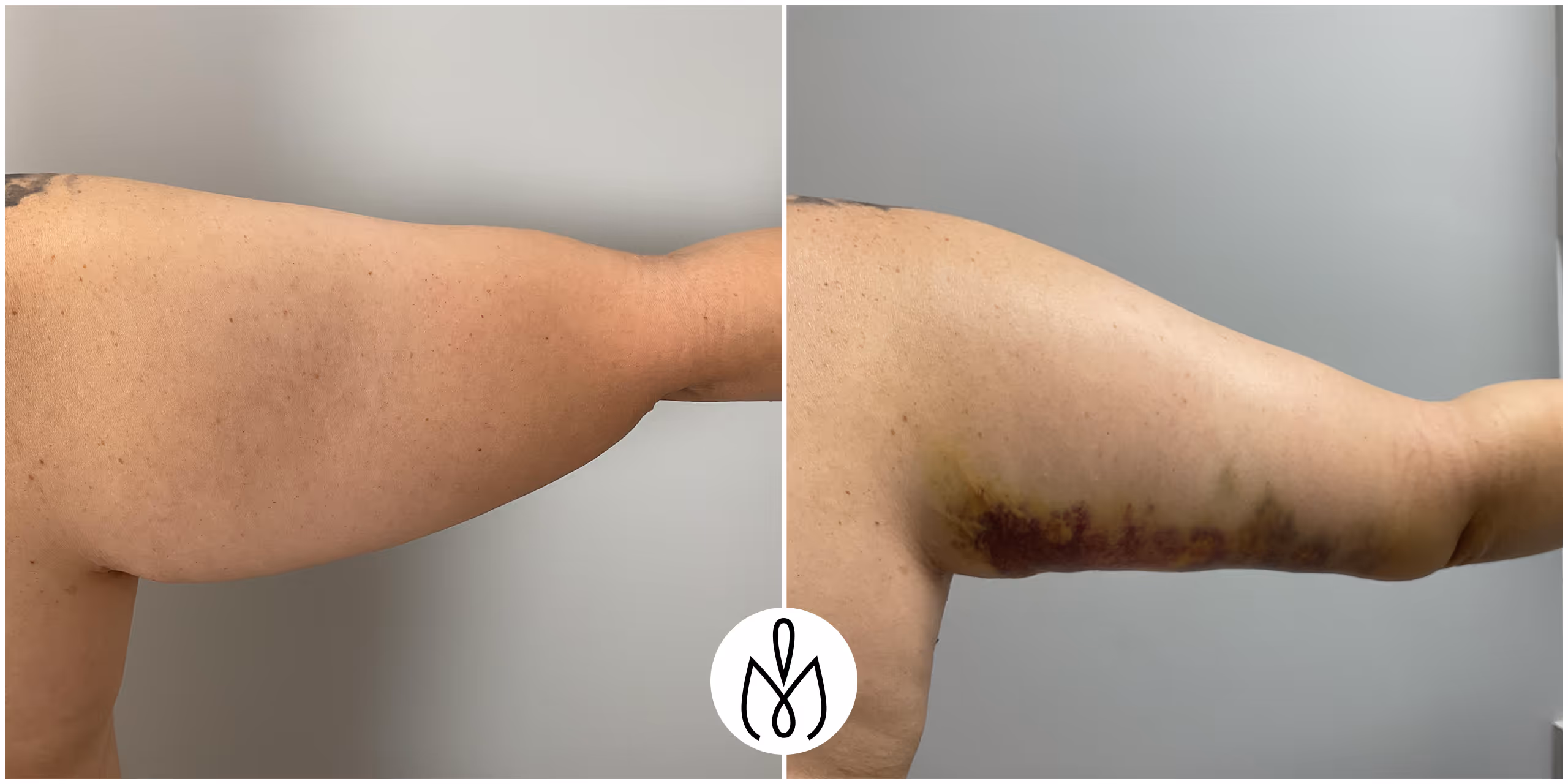 Before,After