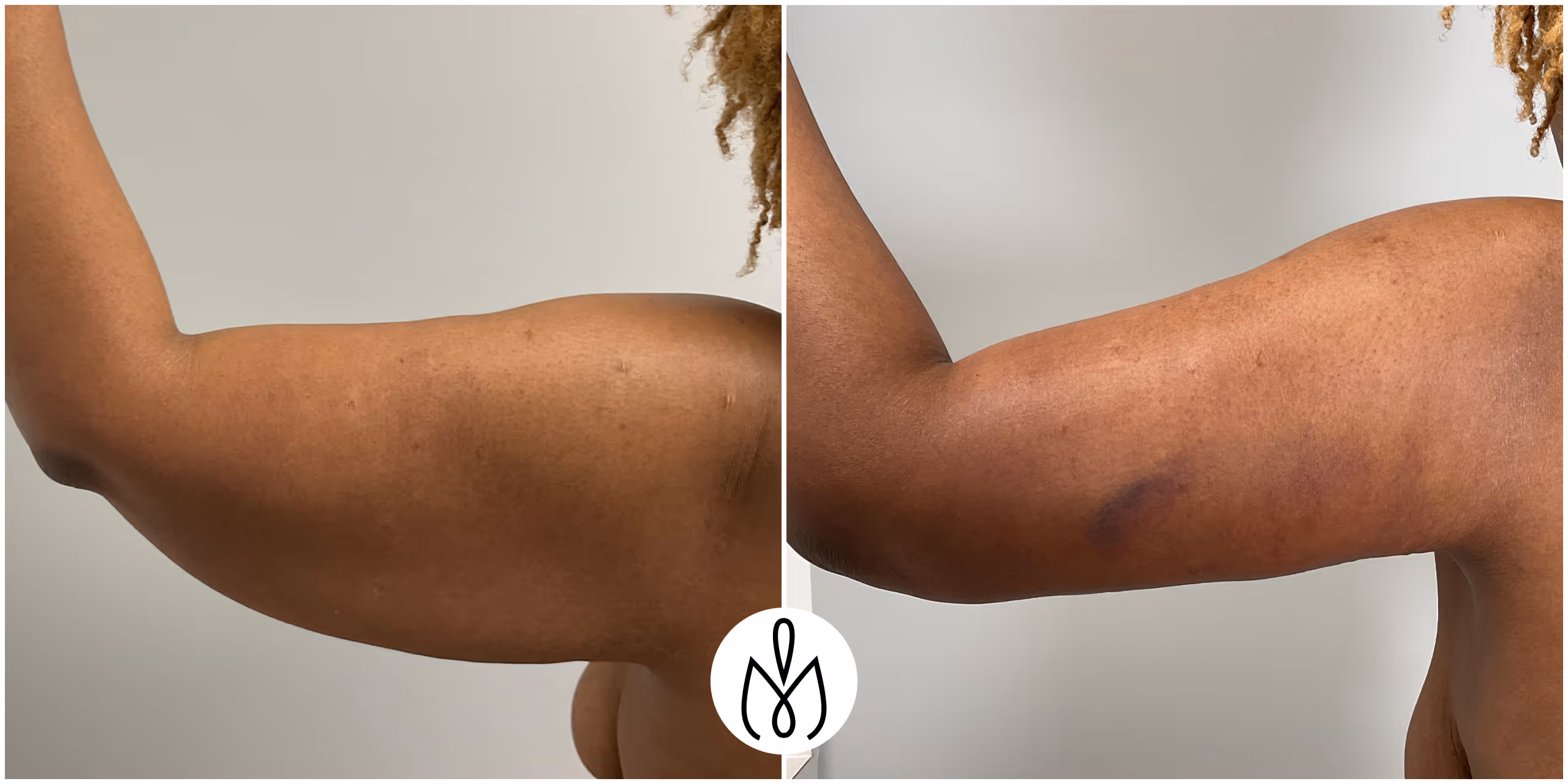 Before,After