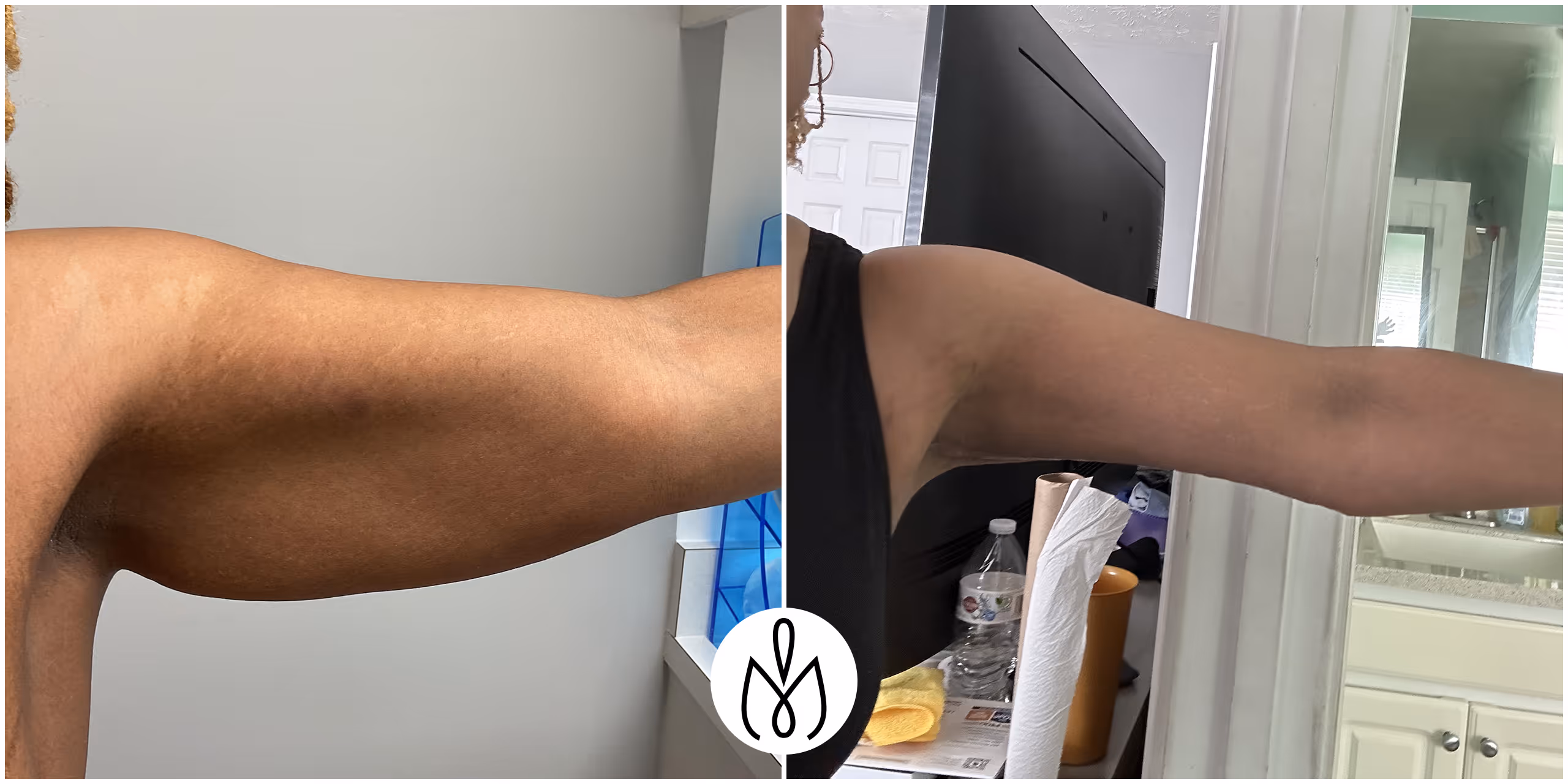 Before,After
