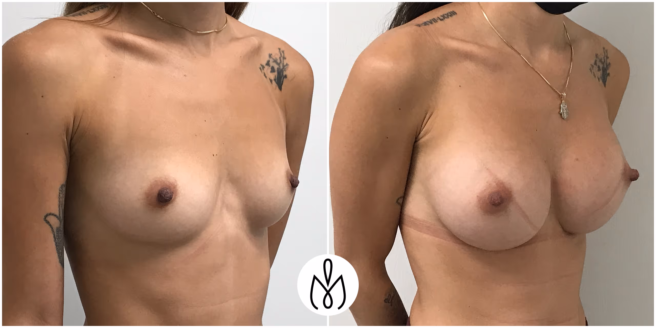 Before,After