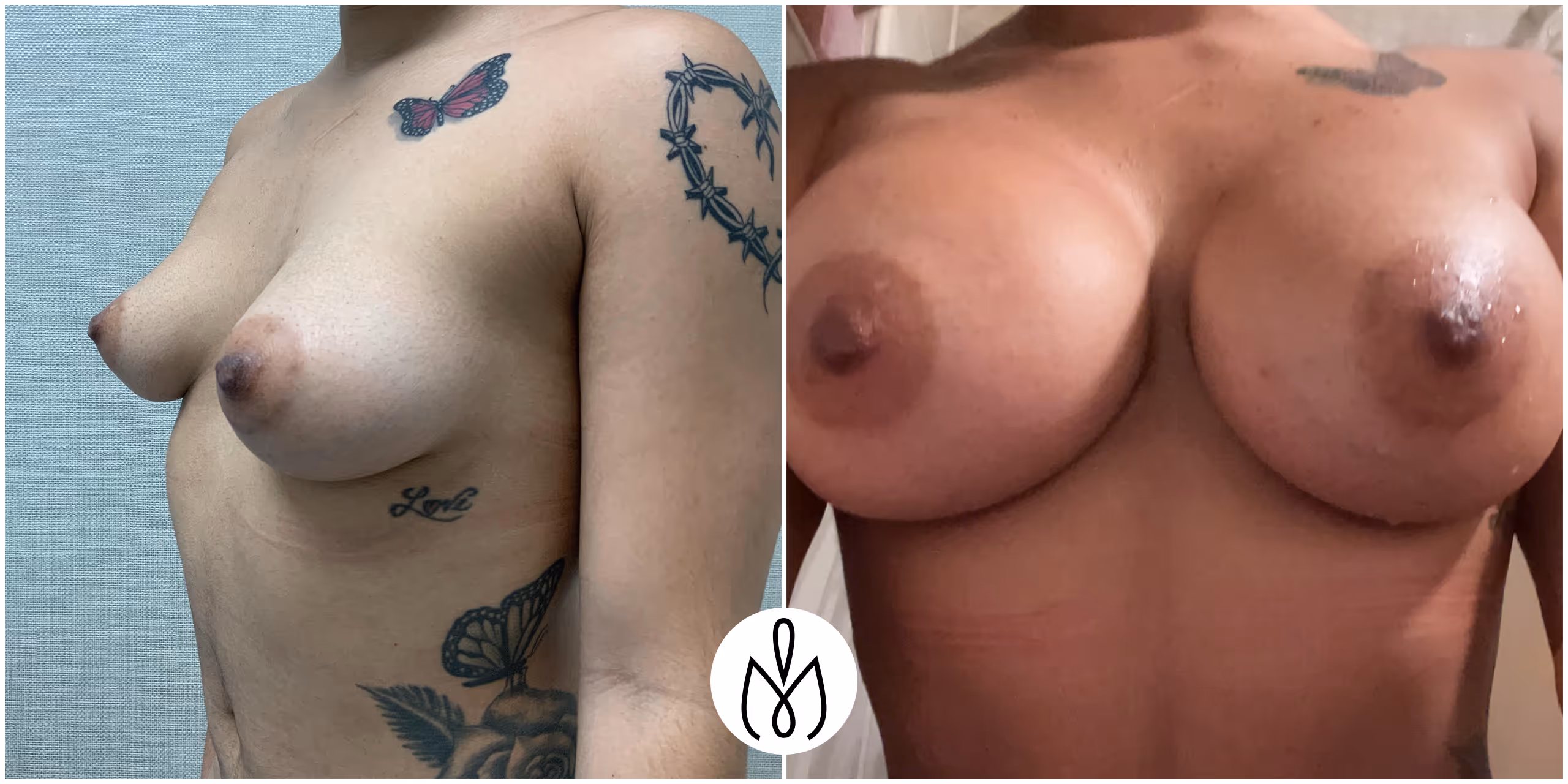 Before,After