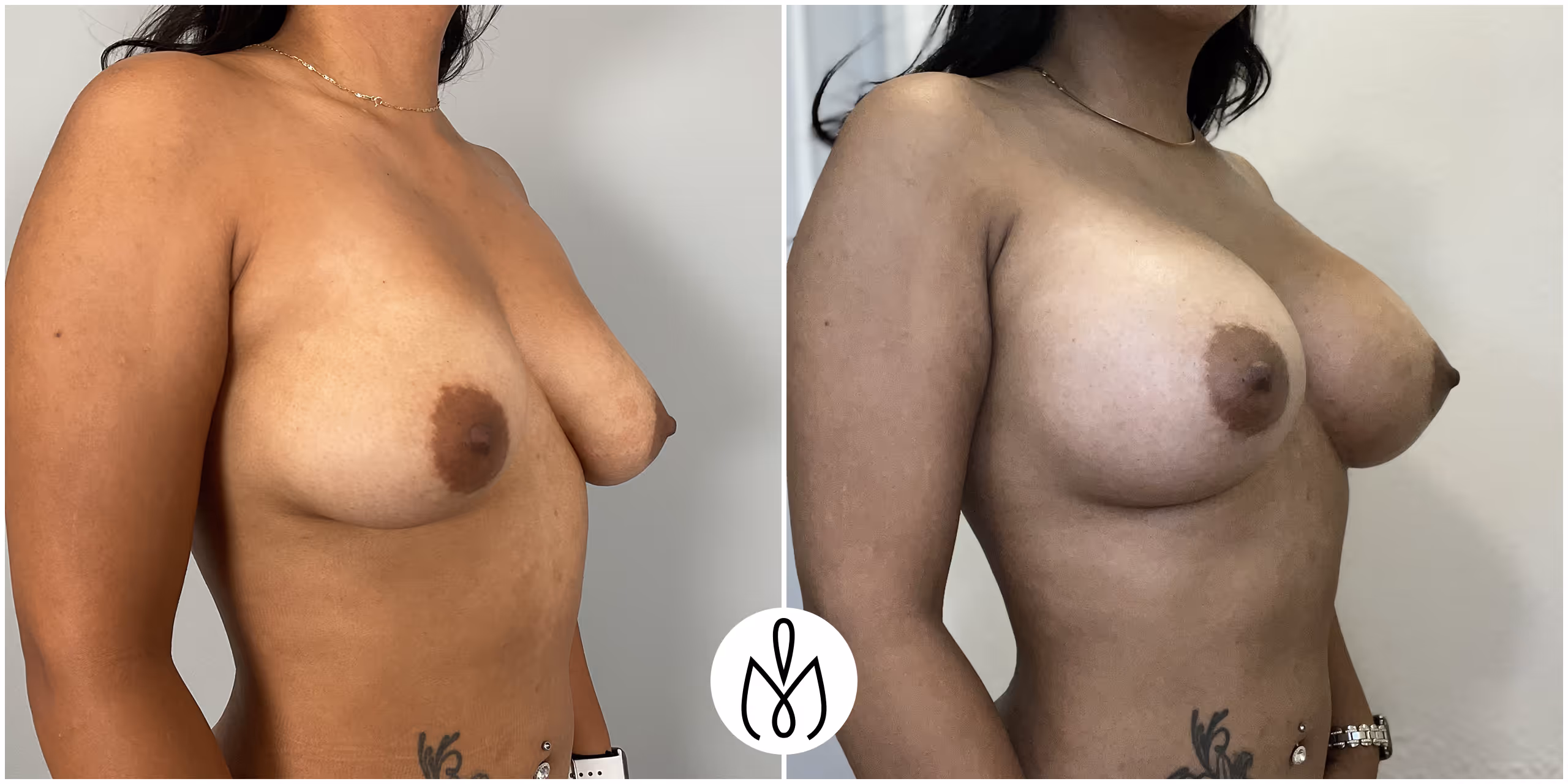 Before,After