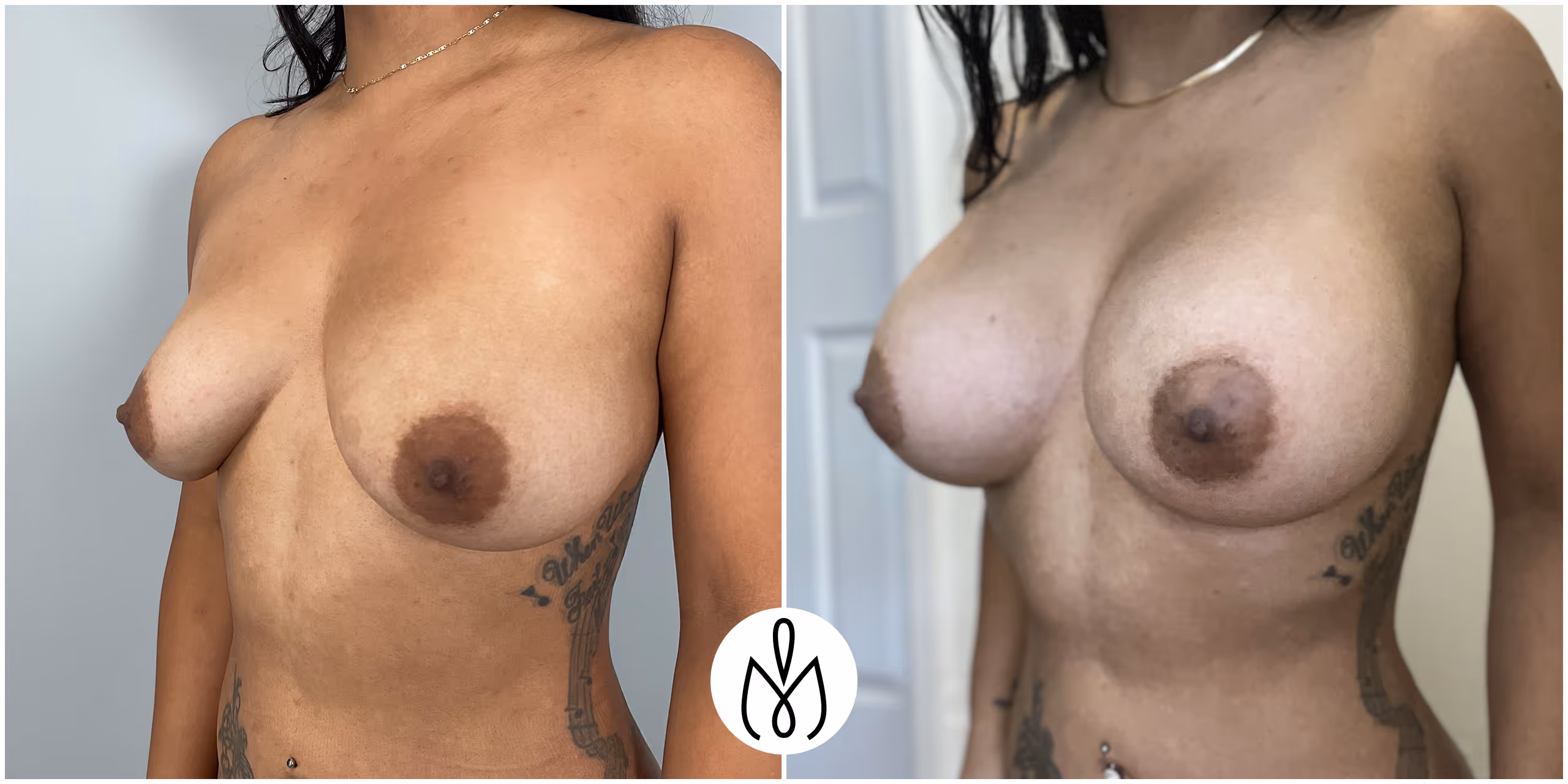 Before,After