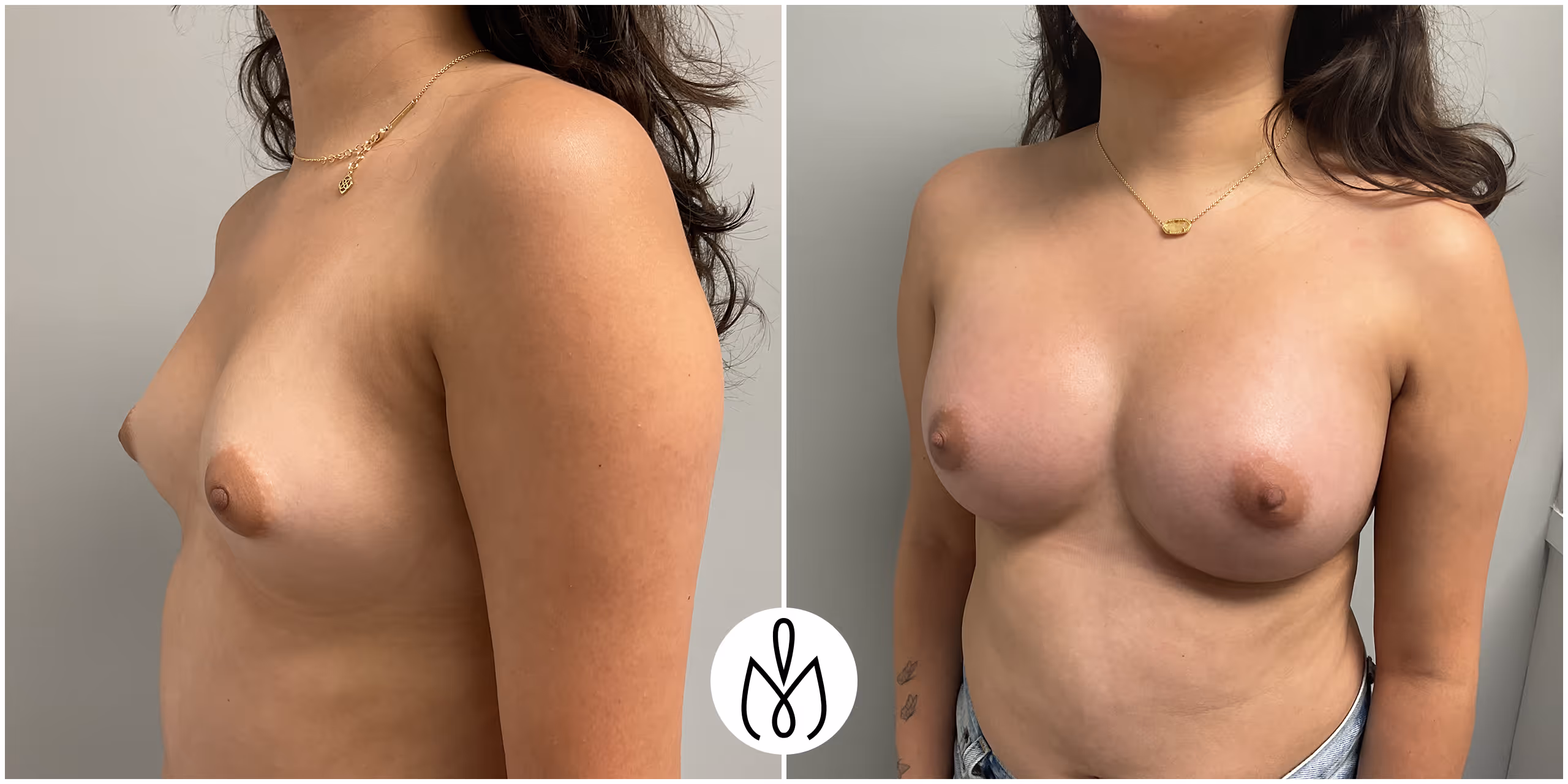 Before,After