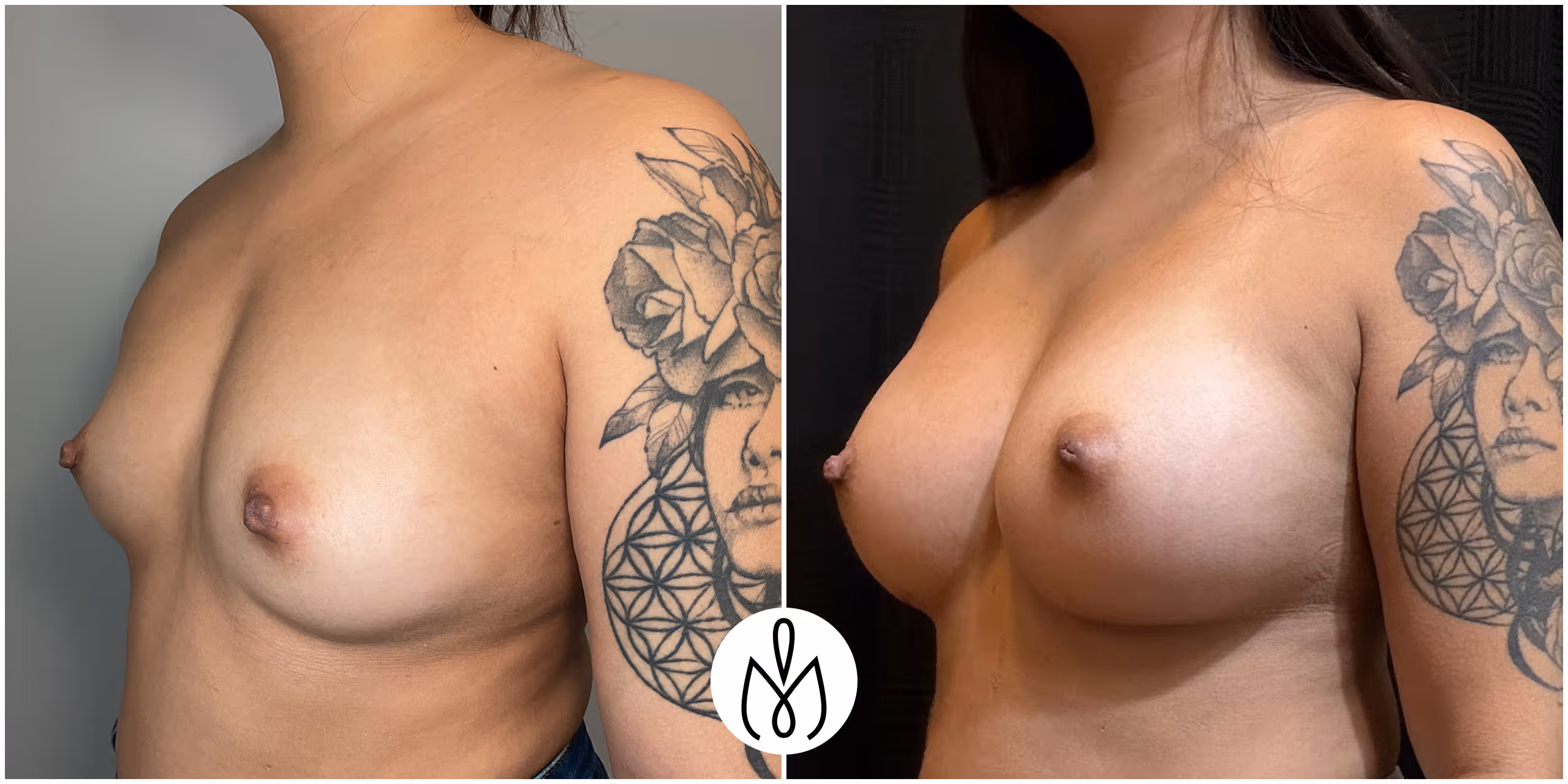 Before,After