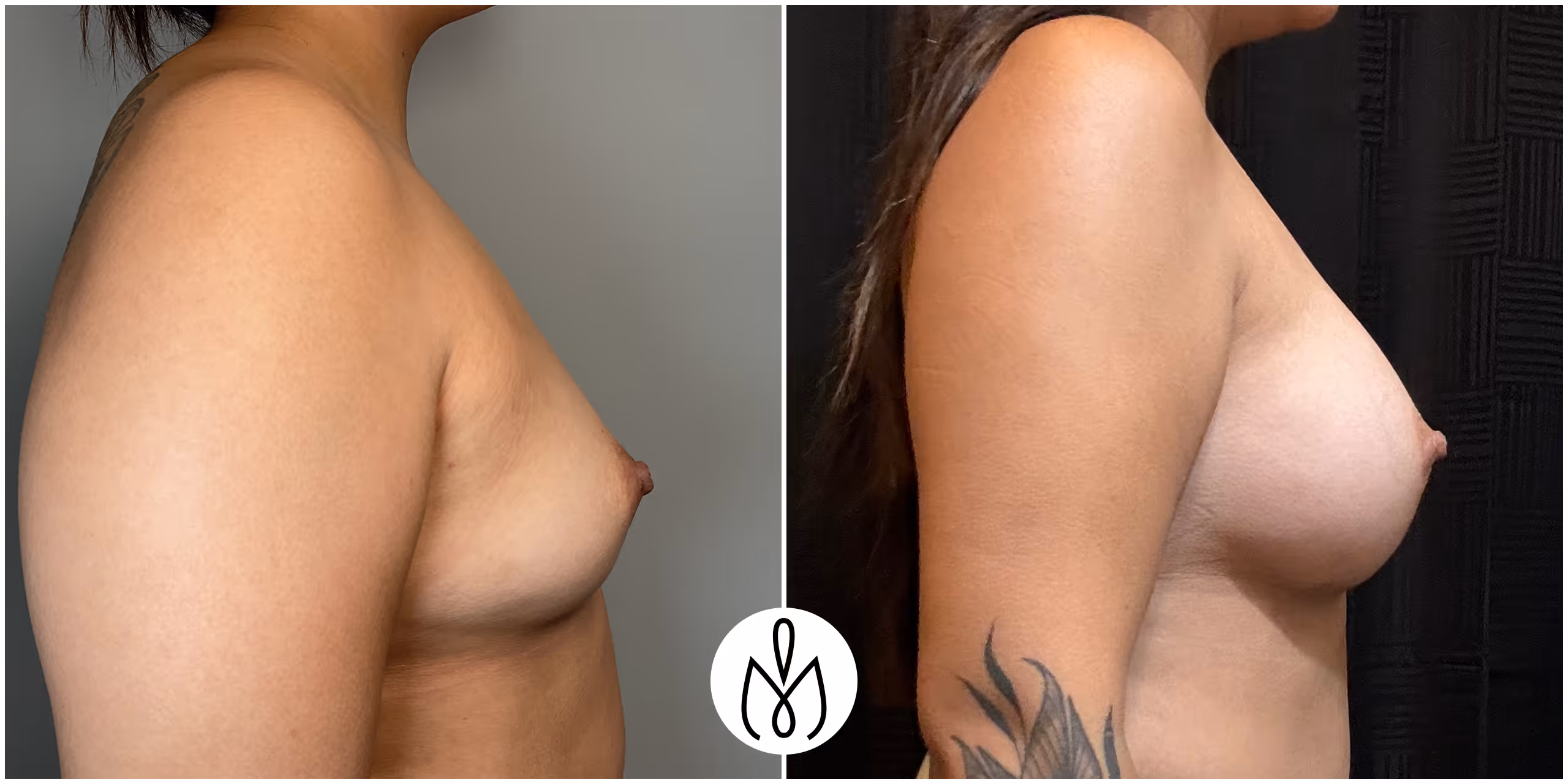 Before,After