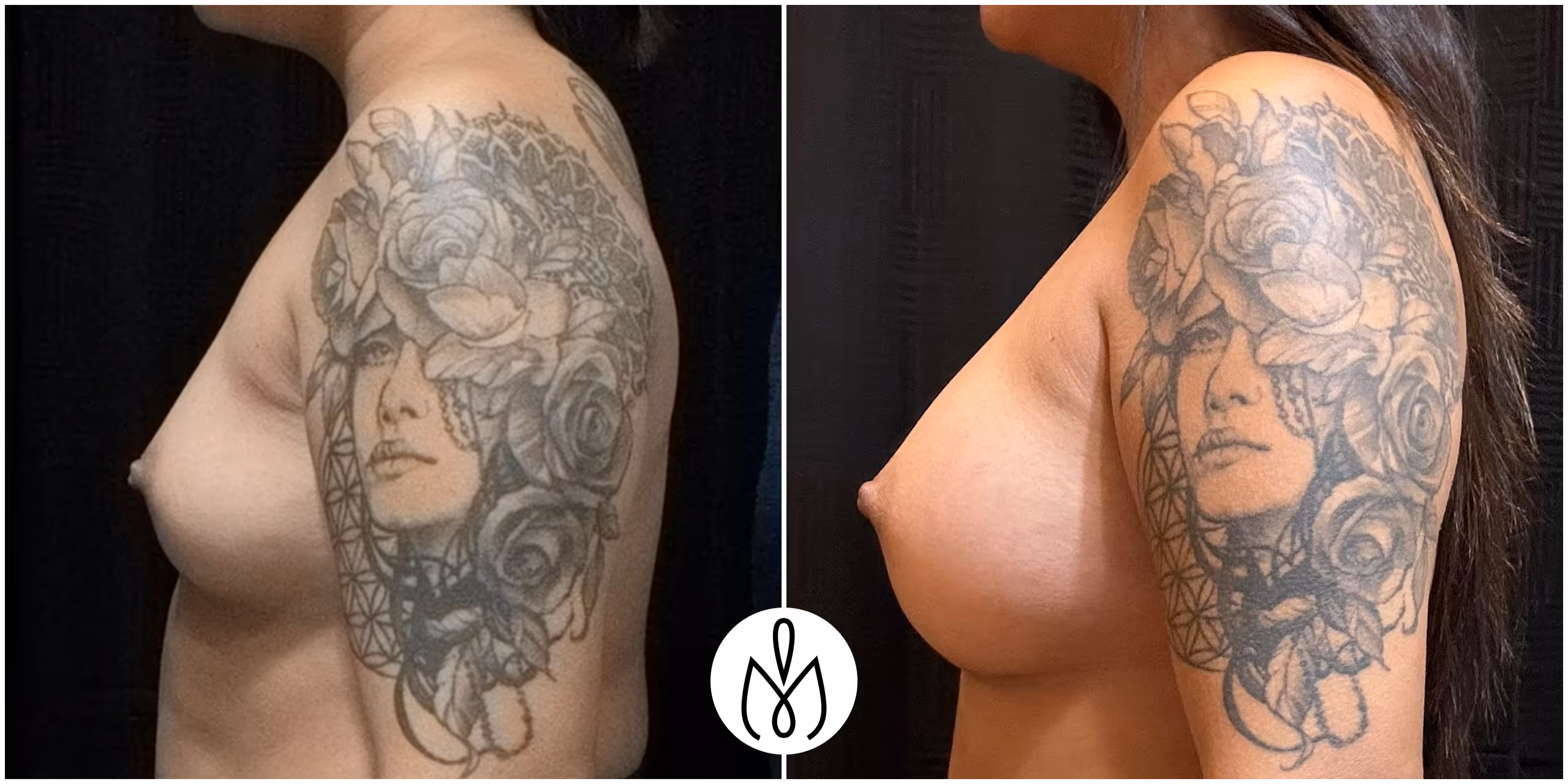 Before,After