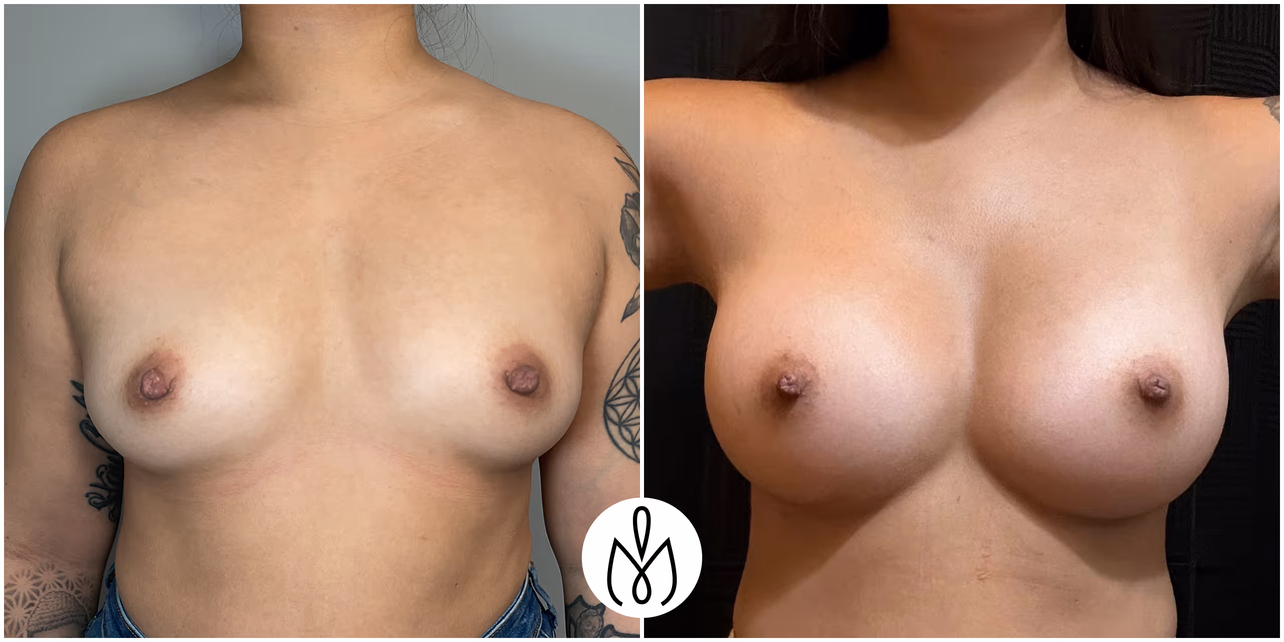Before,After