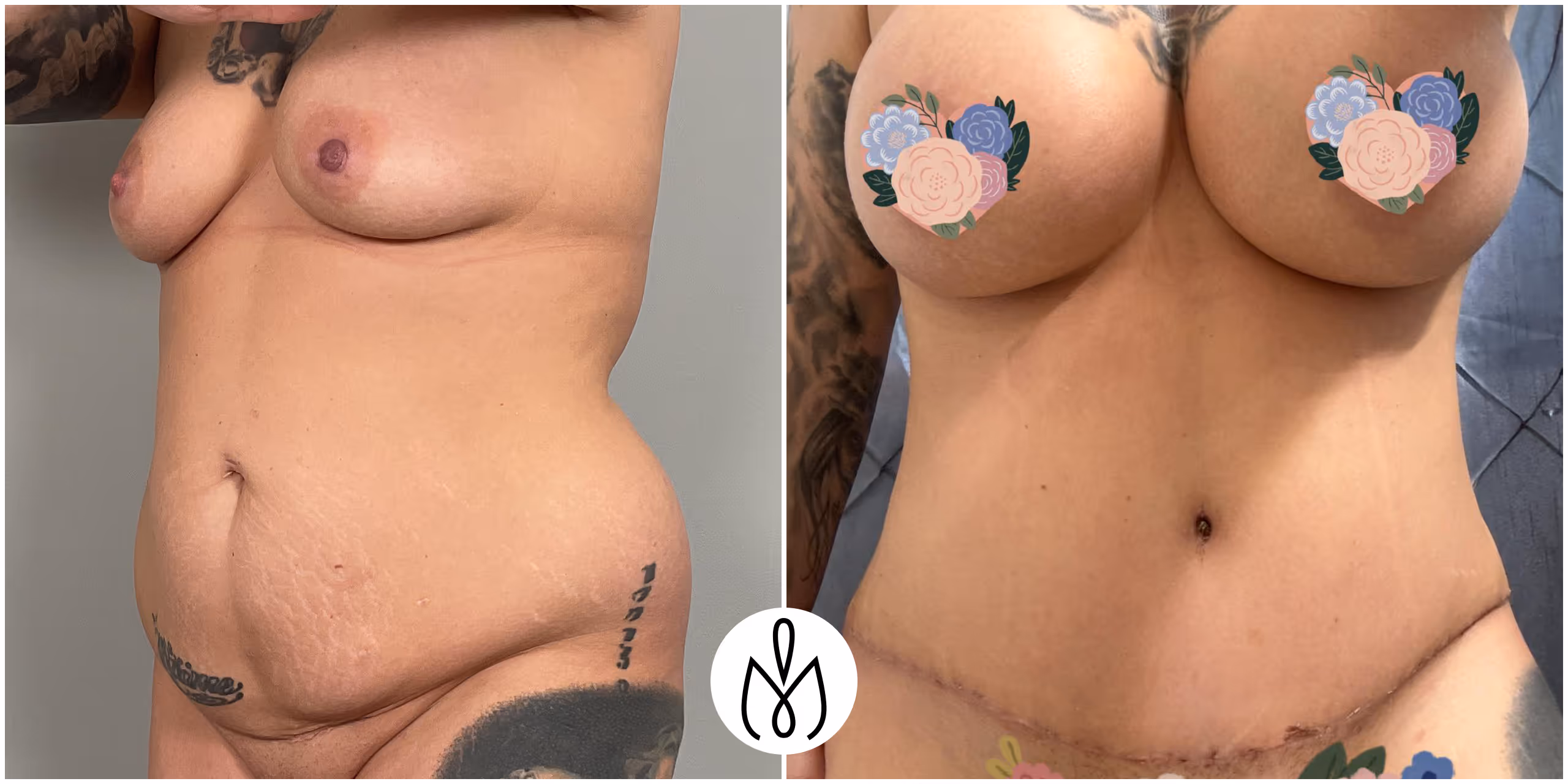 Before,After