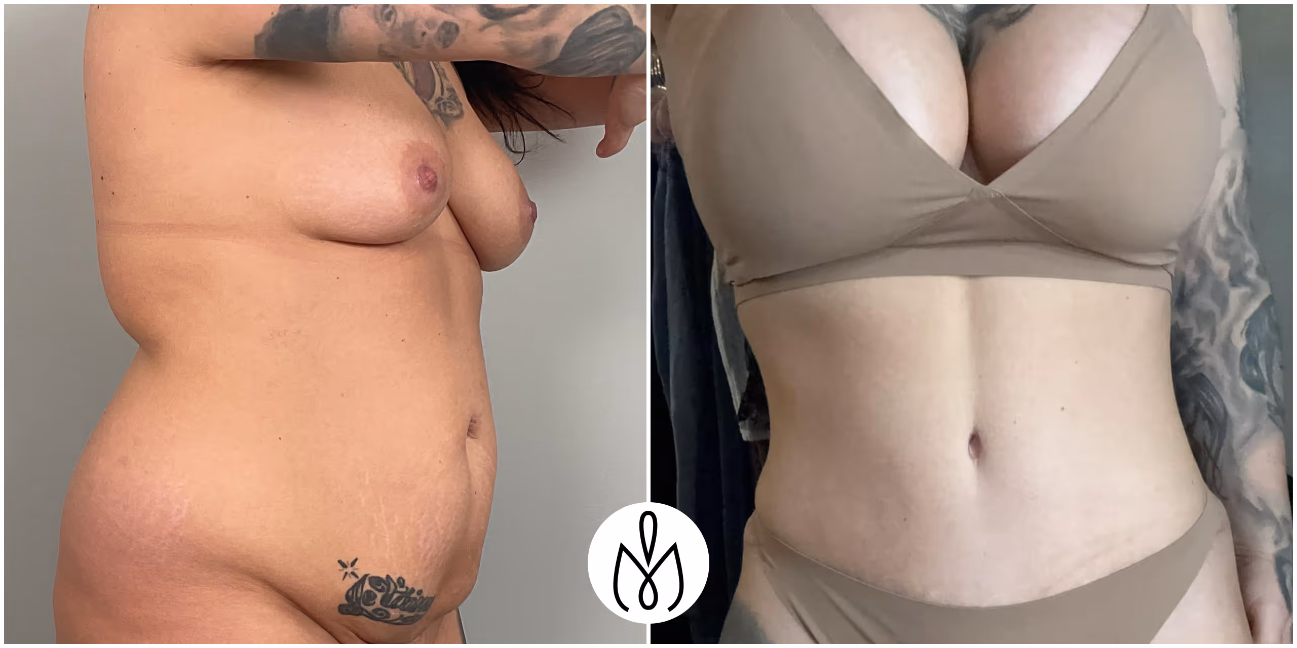 Before,After