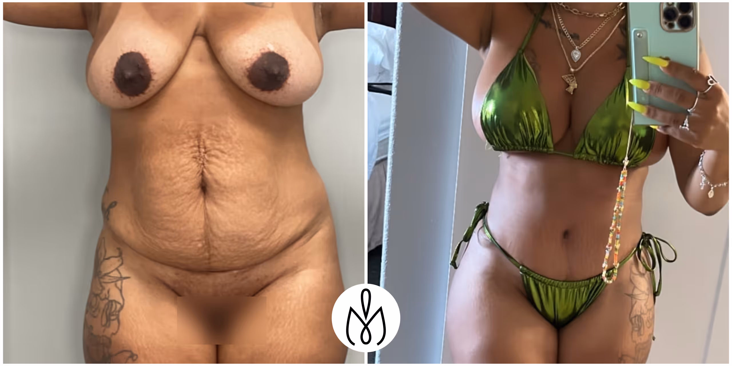 Before,After