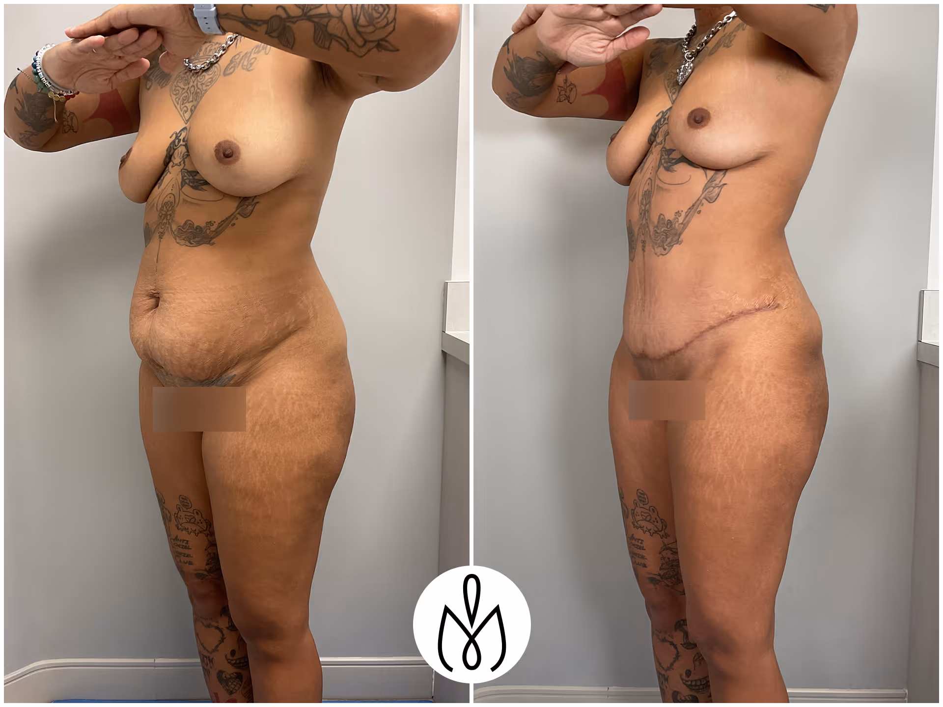 Before,After