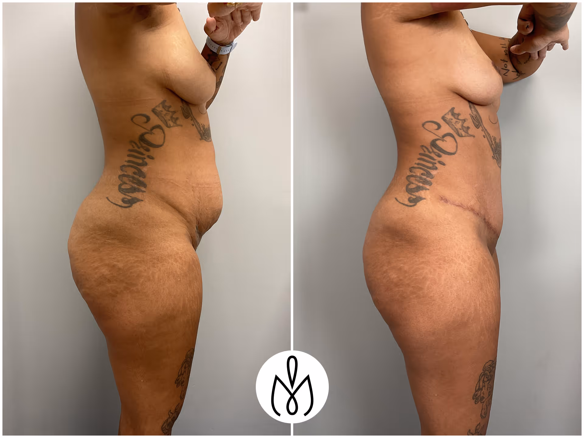 Before,After