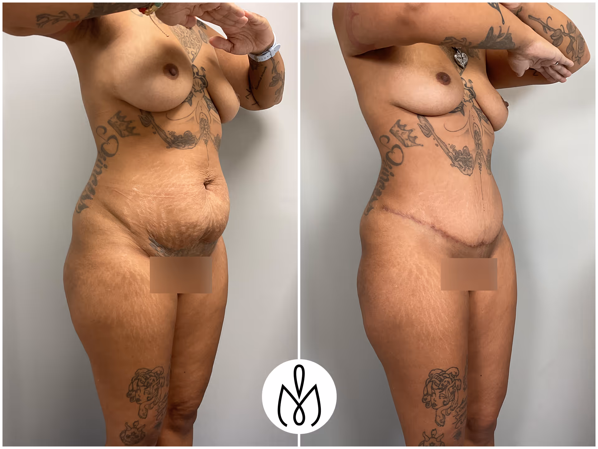 Before,After