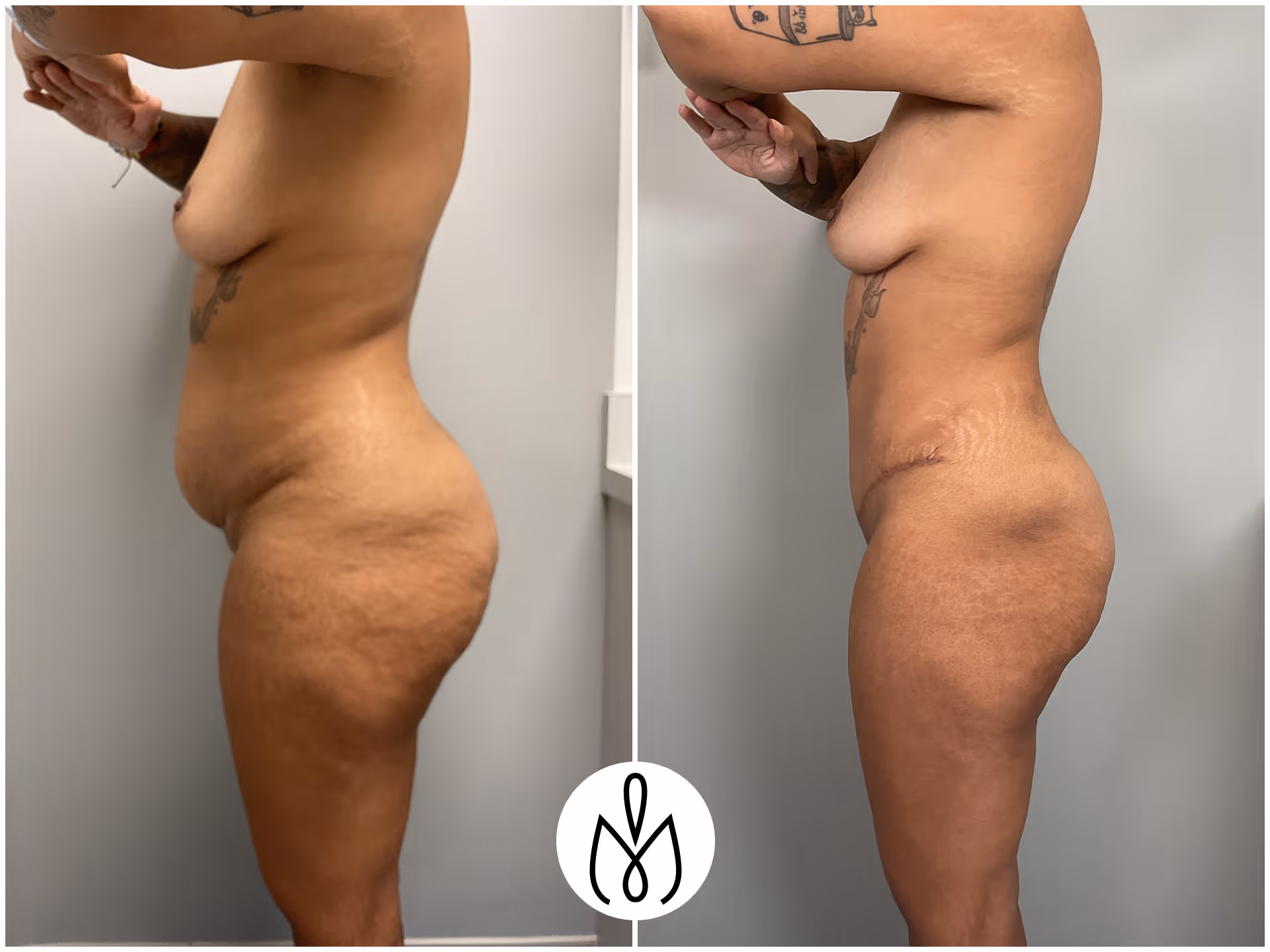 Before,After