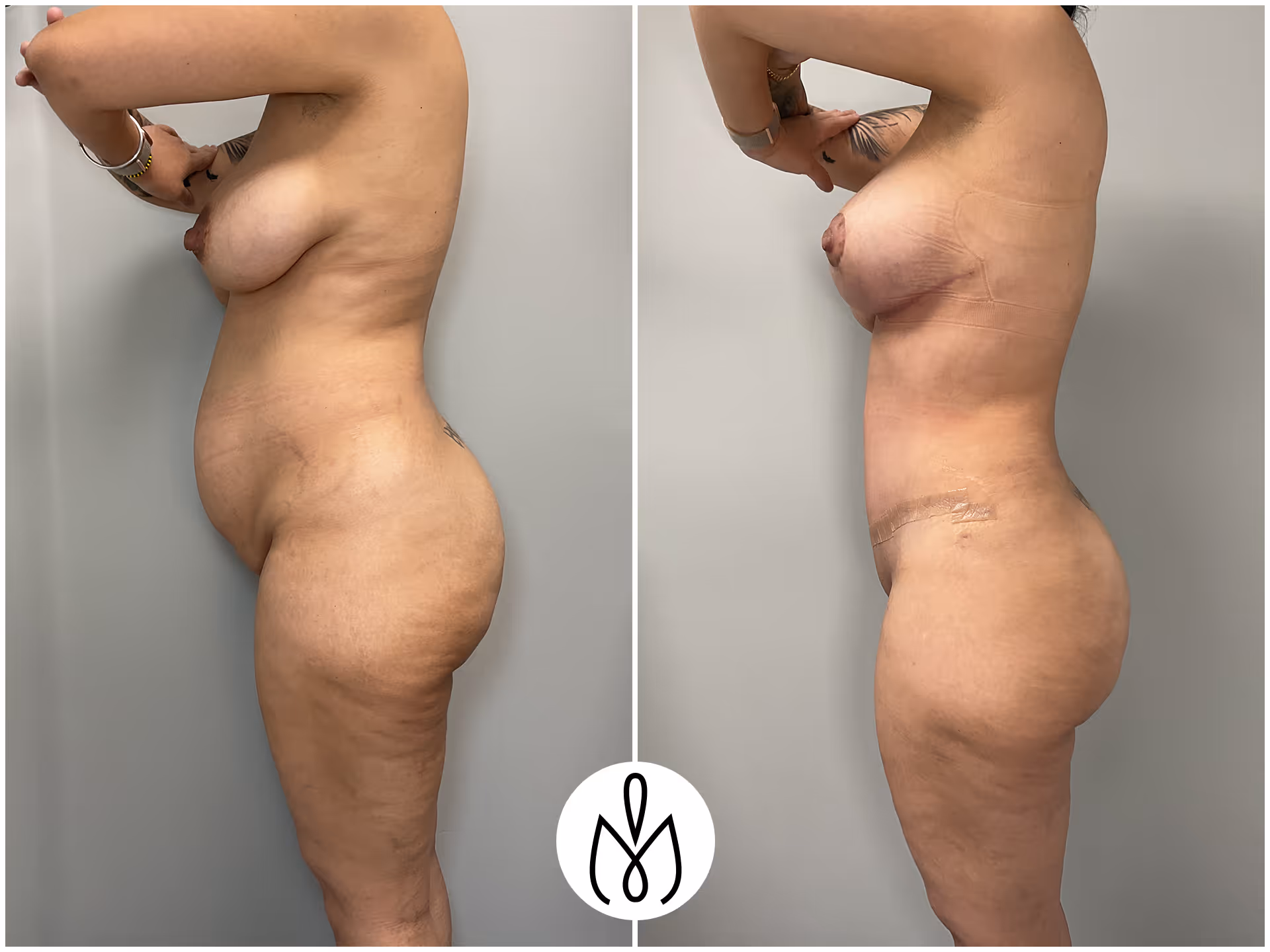 Before,After