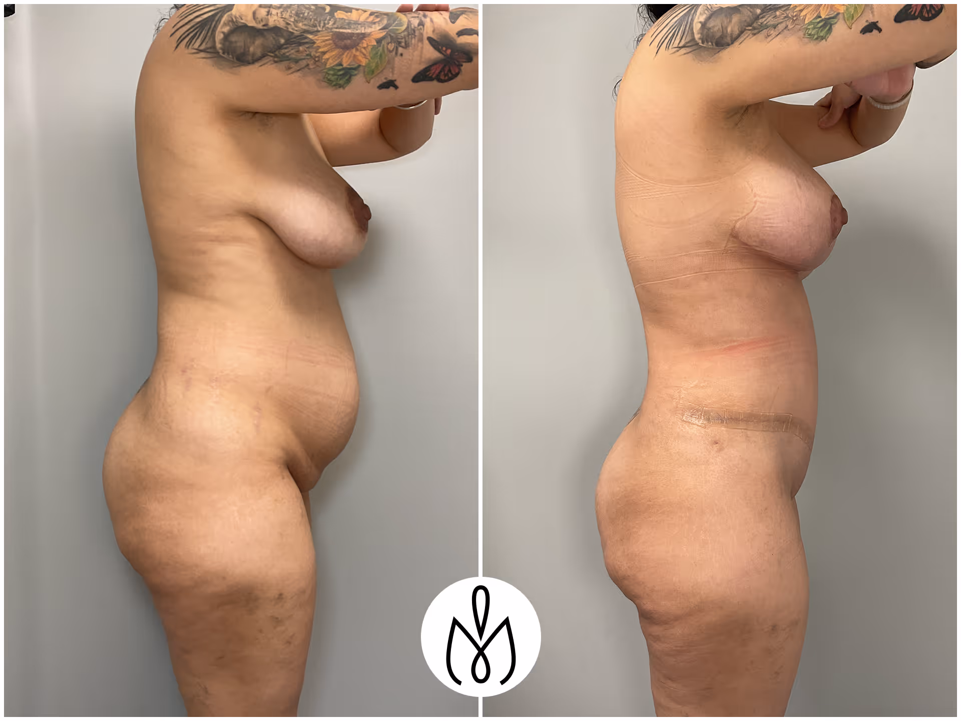 Before,After