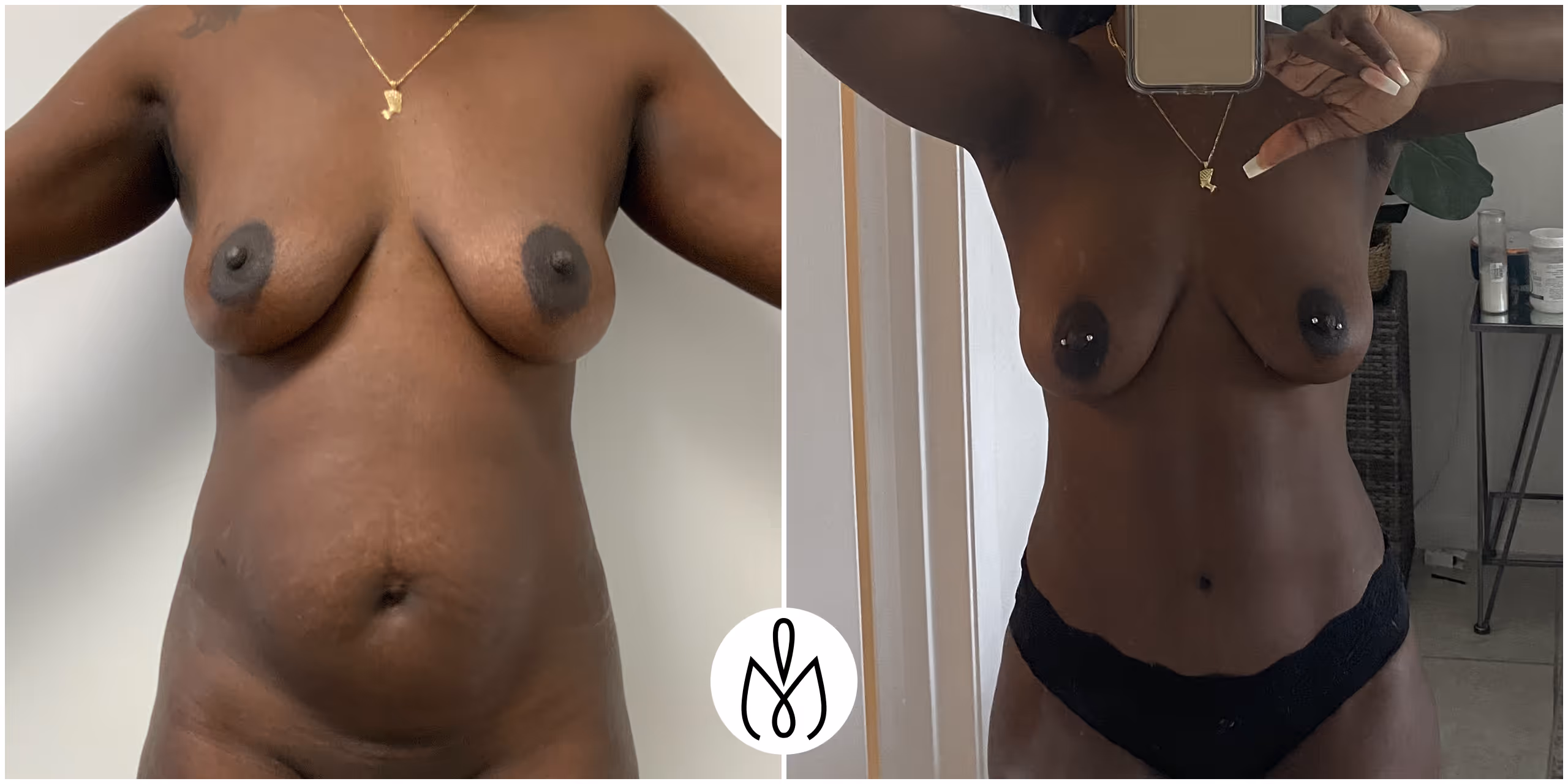 Before,After
