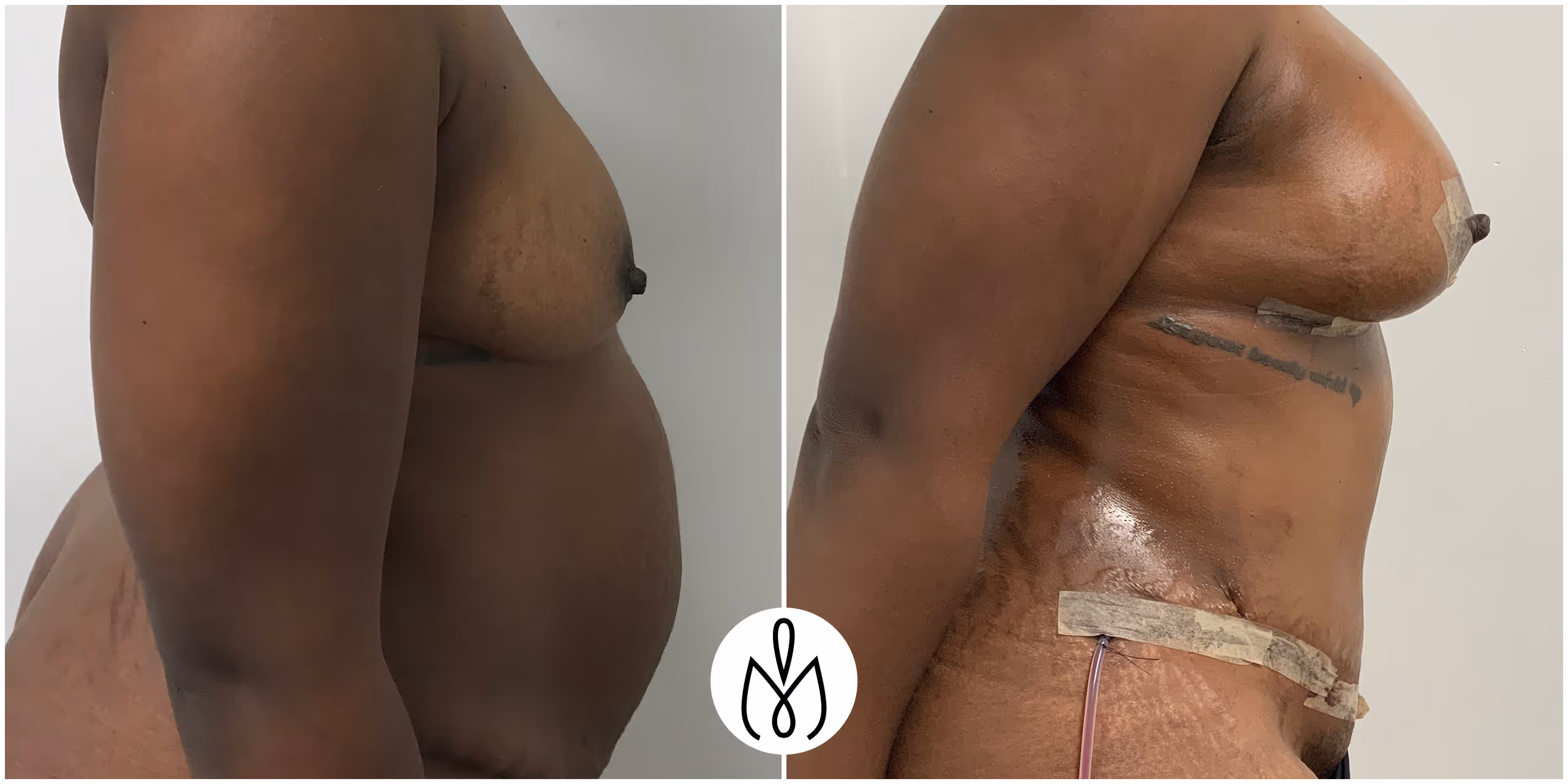 Before,After