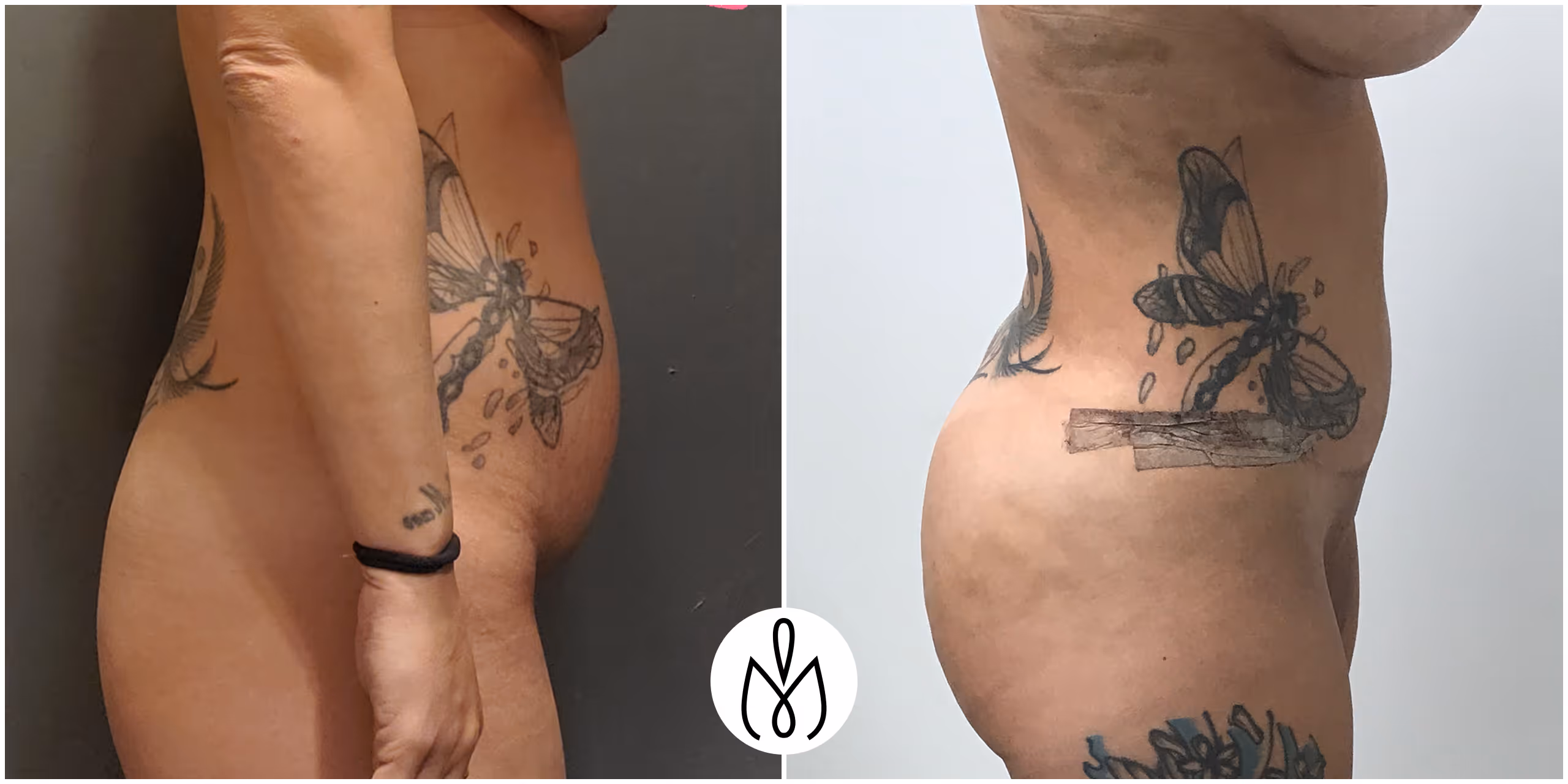 Before,After