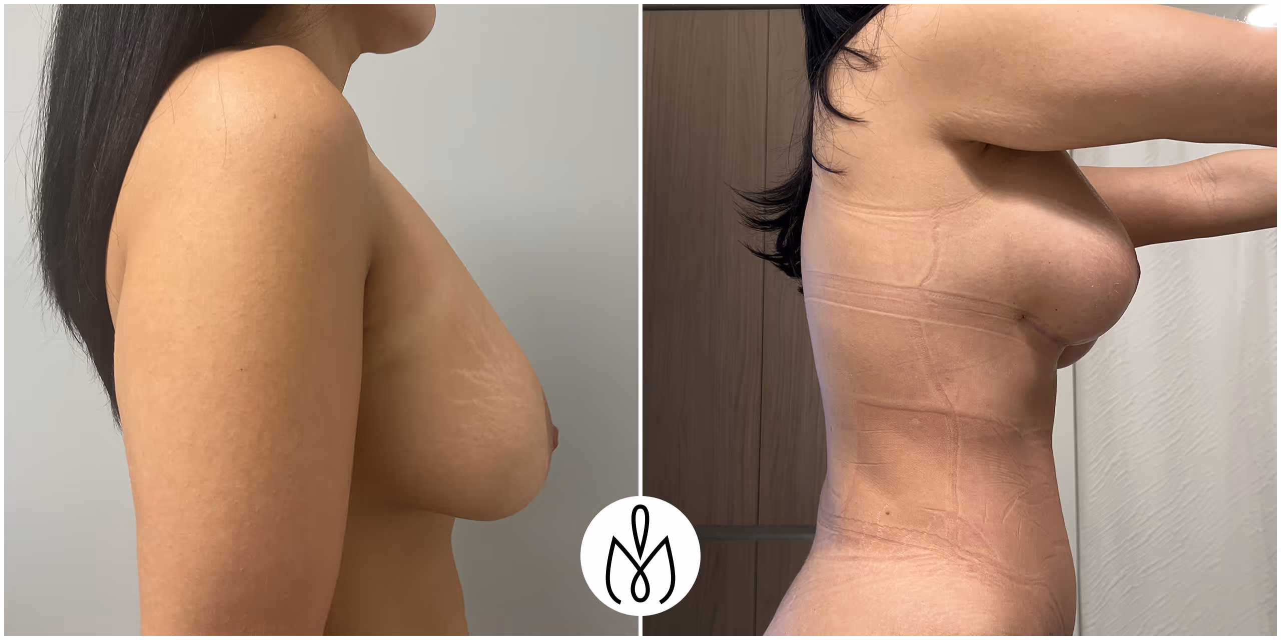 Before,After