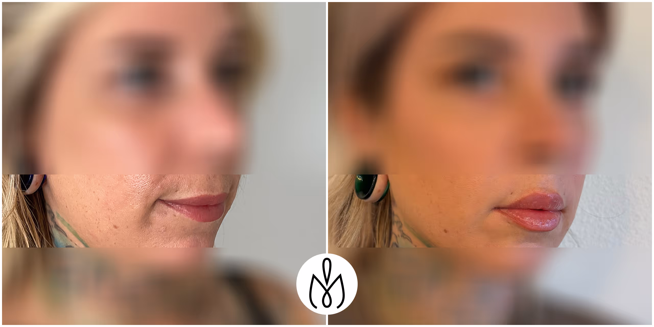 Before,After