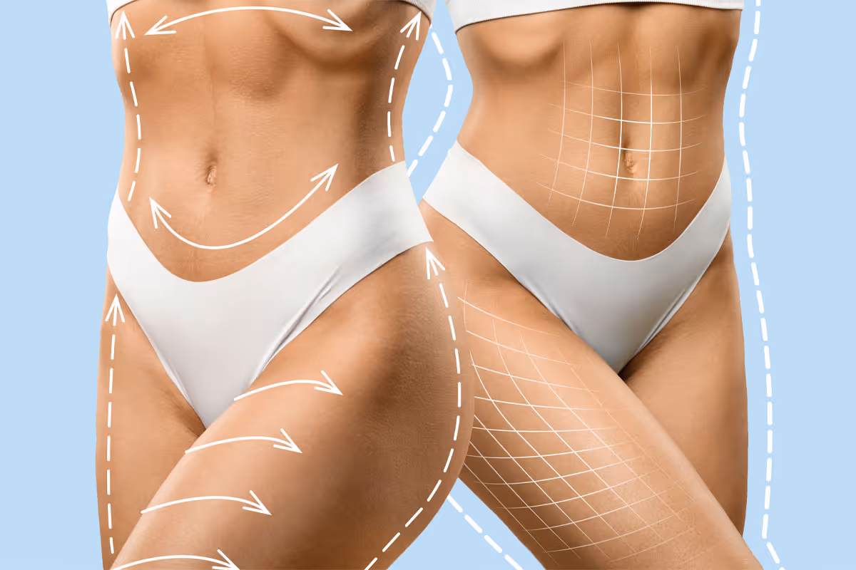 How Body Contouring Can Transform Your Self-Image