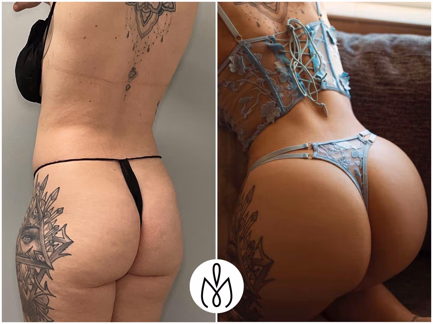 Before,After
