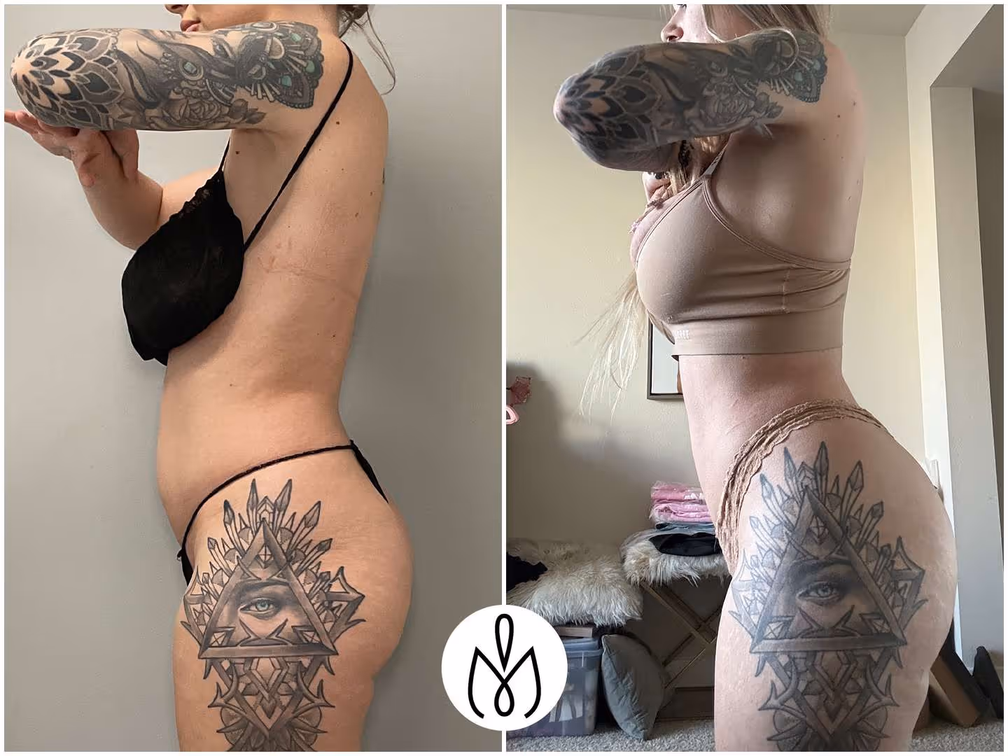Before,After