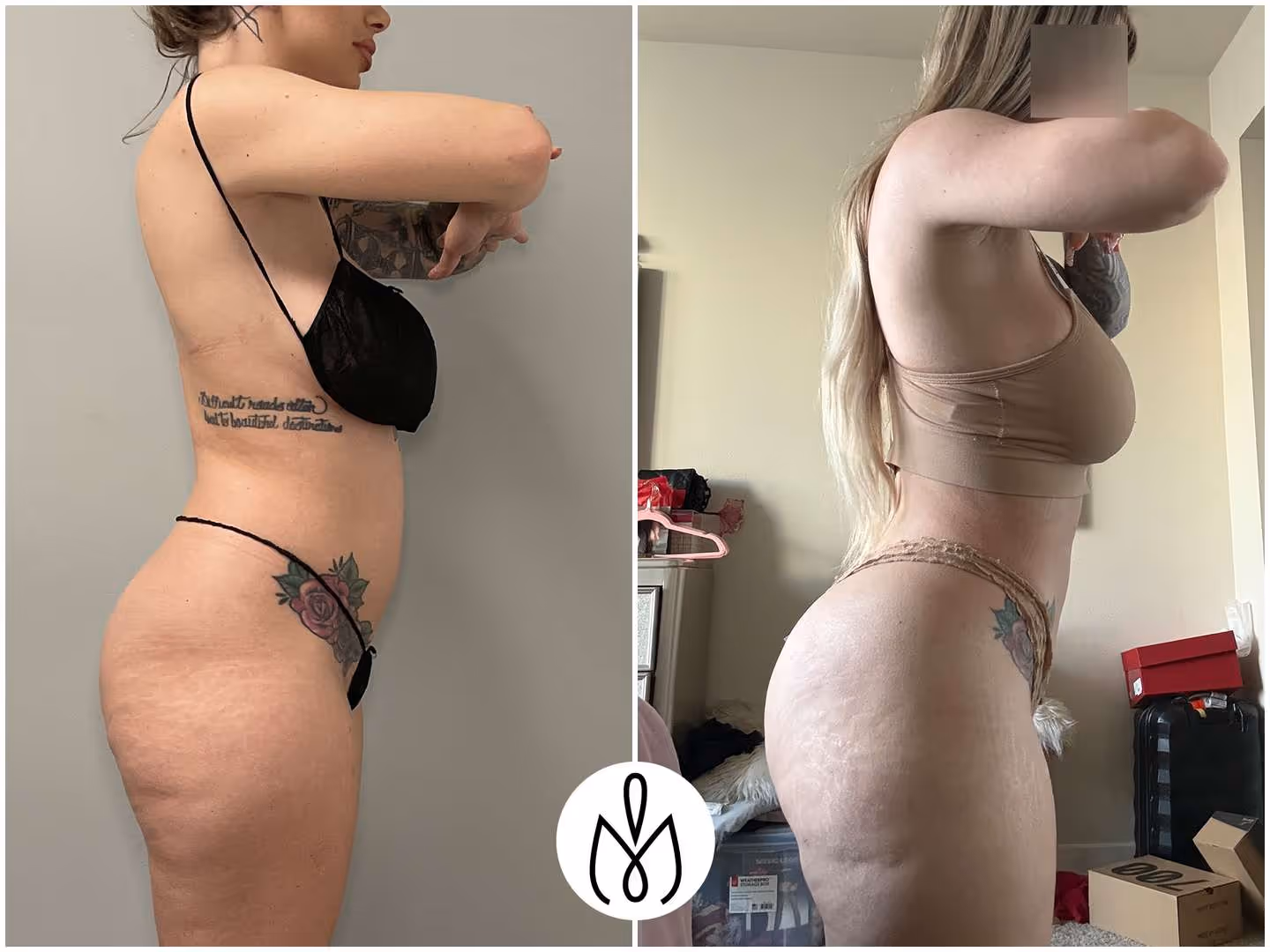 Before,After