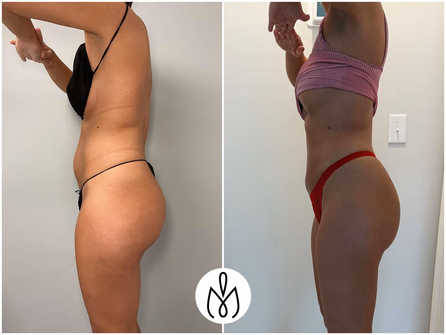 Before,After