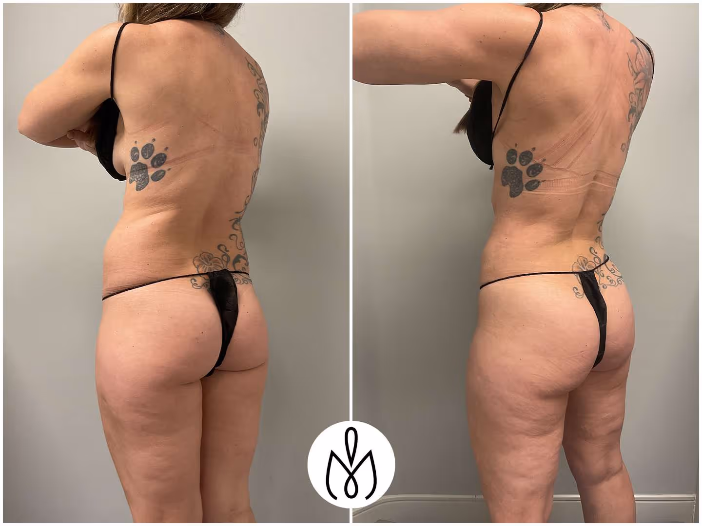 Before,After
